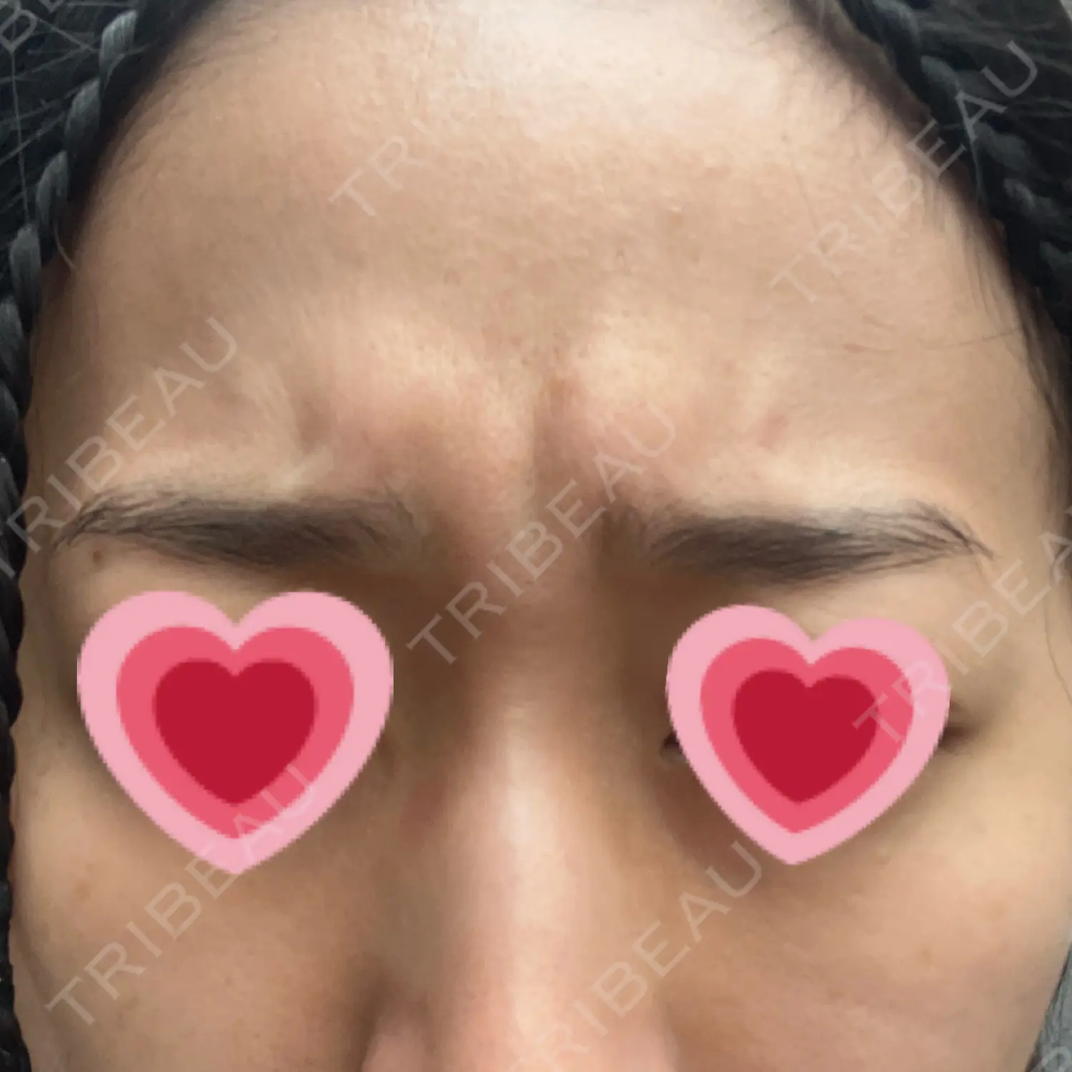 施術前の写真