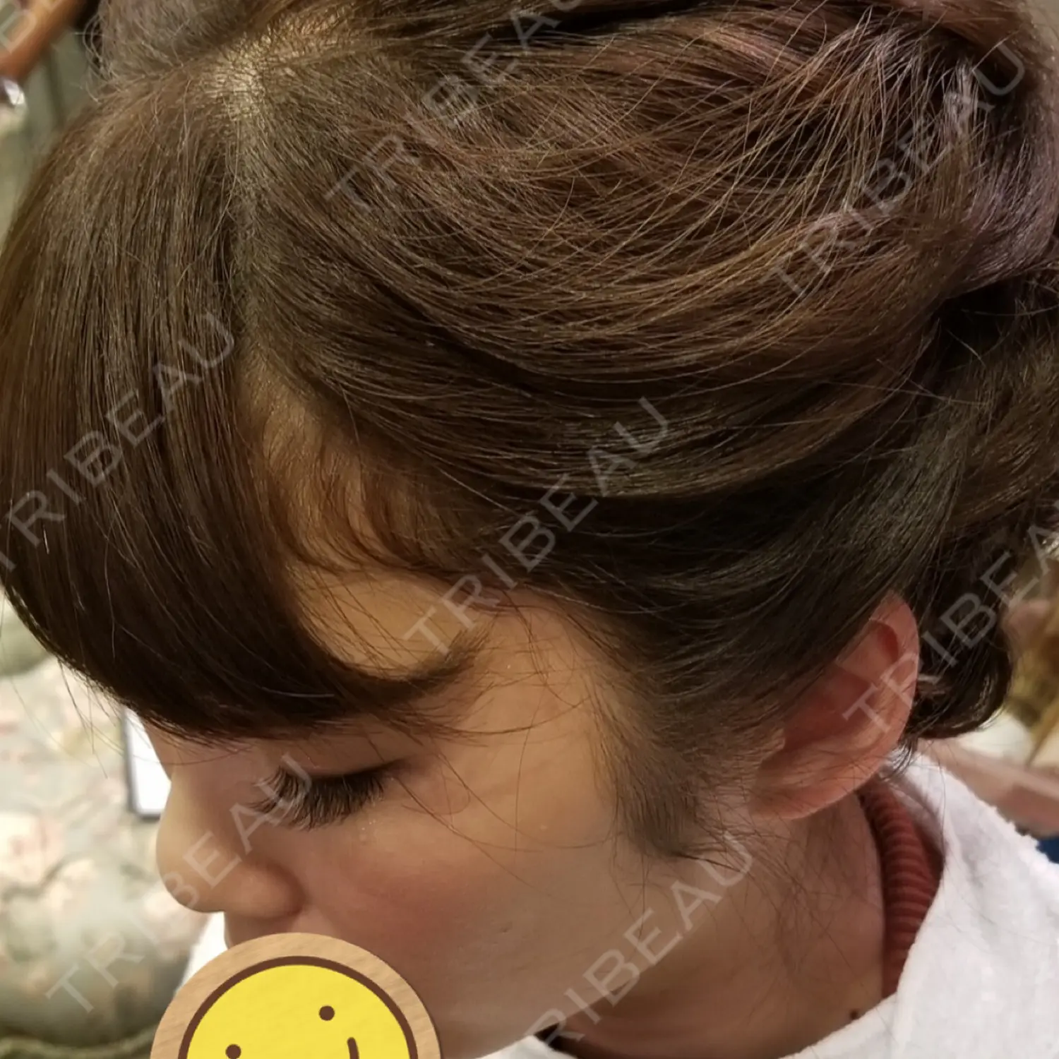 施術前の写真