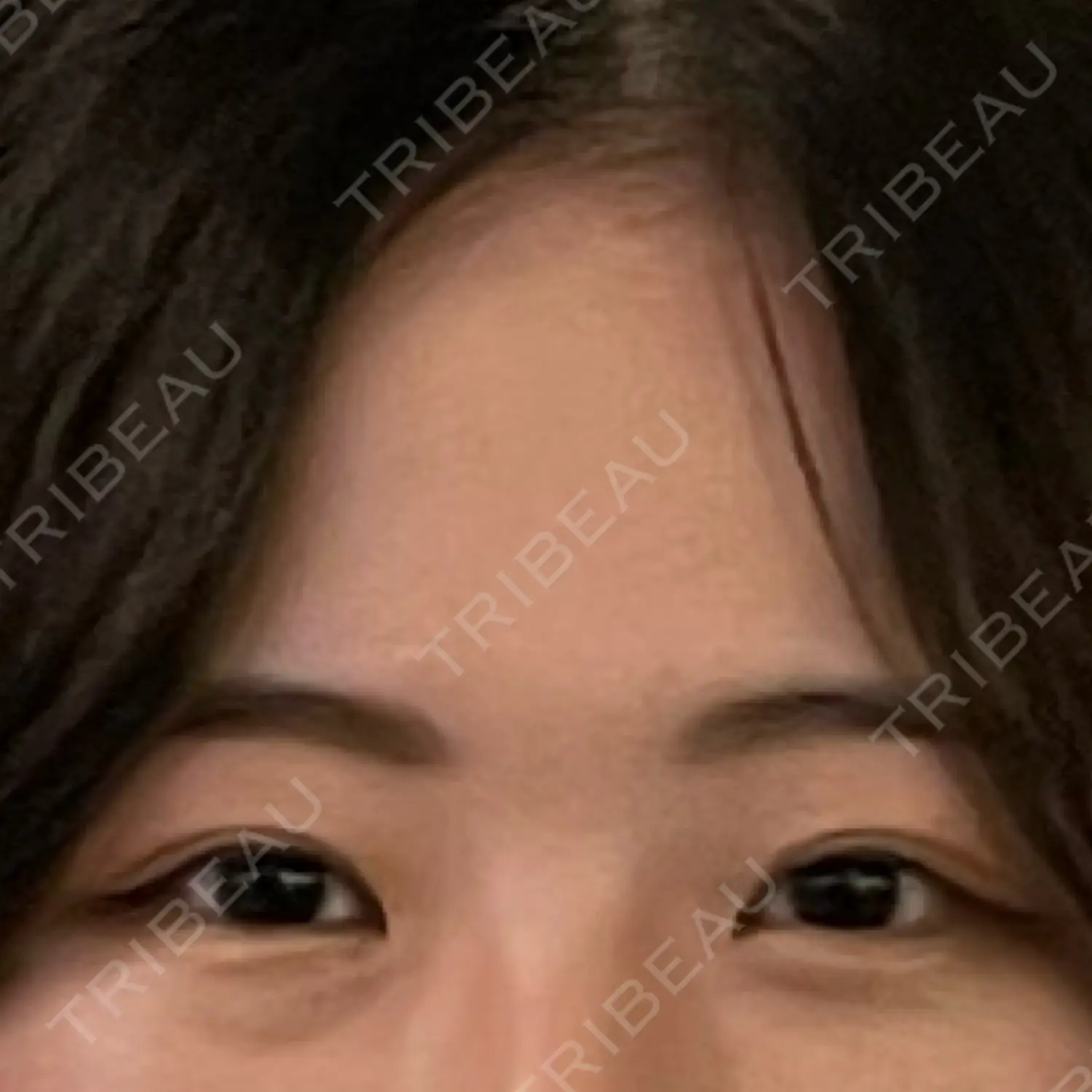 施術前の写真