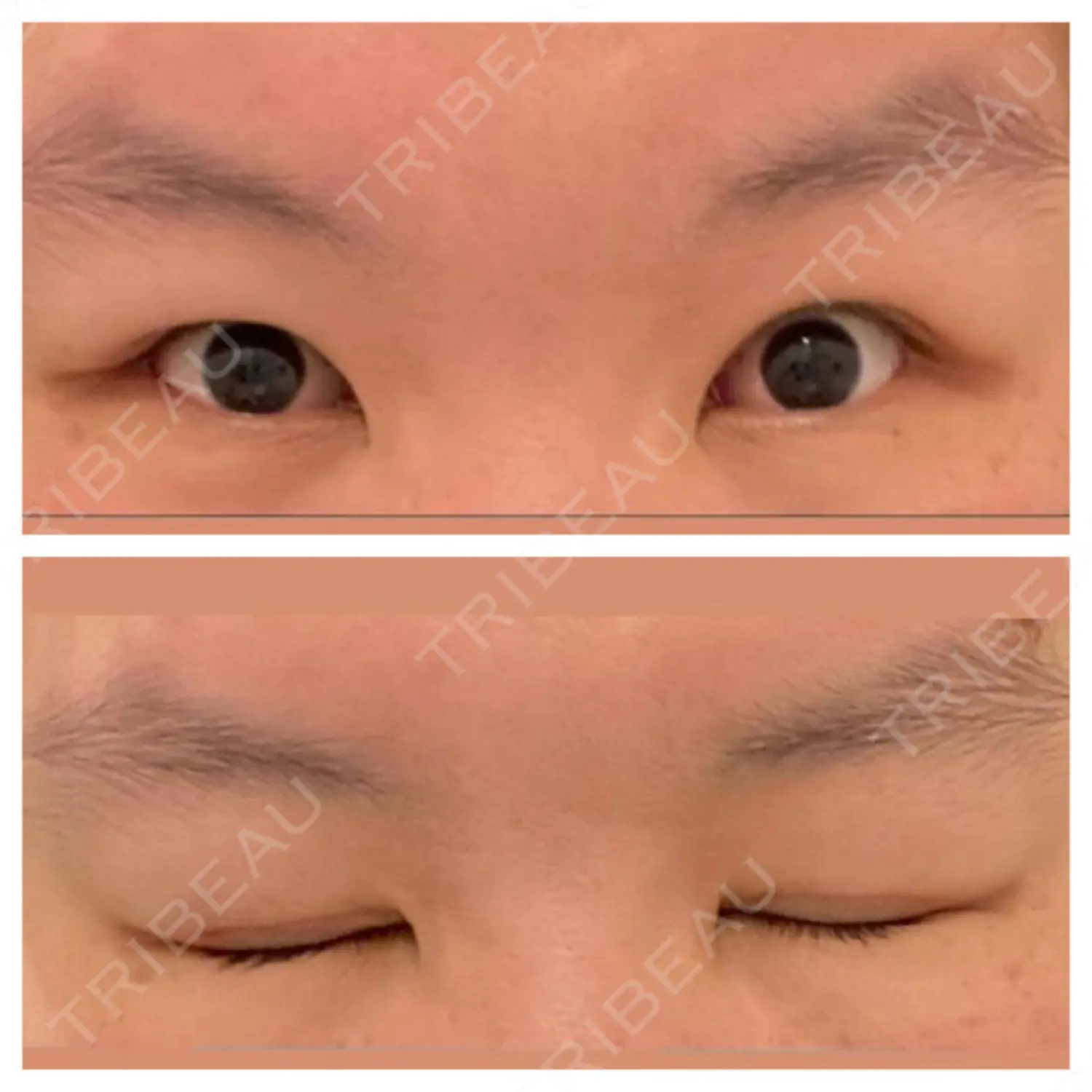 施術前の写真