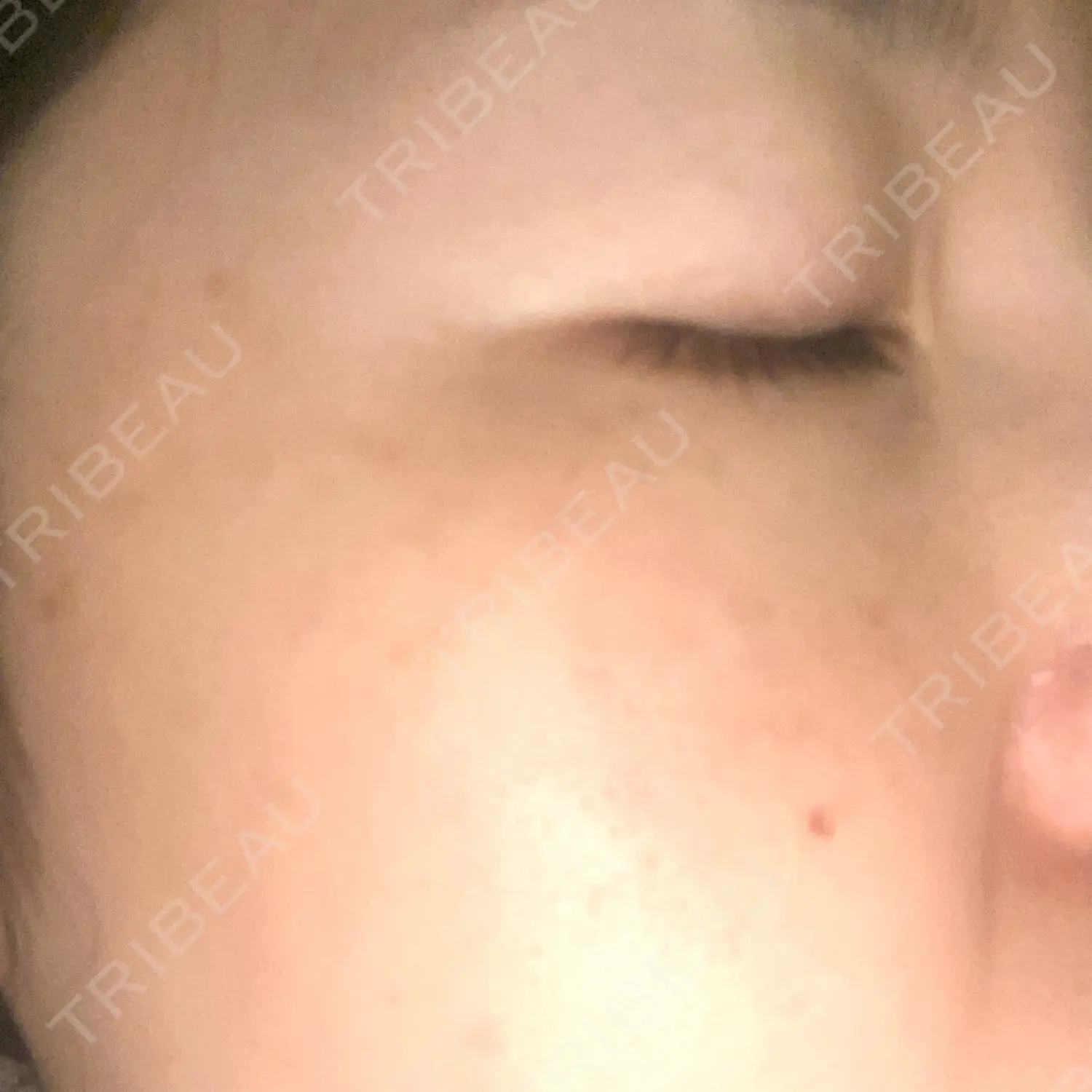 施術前の写真