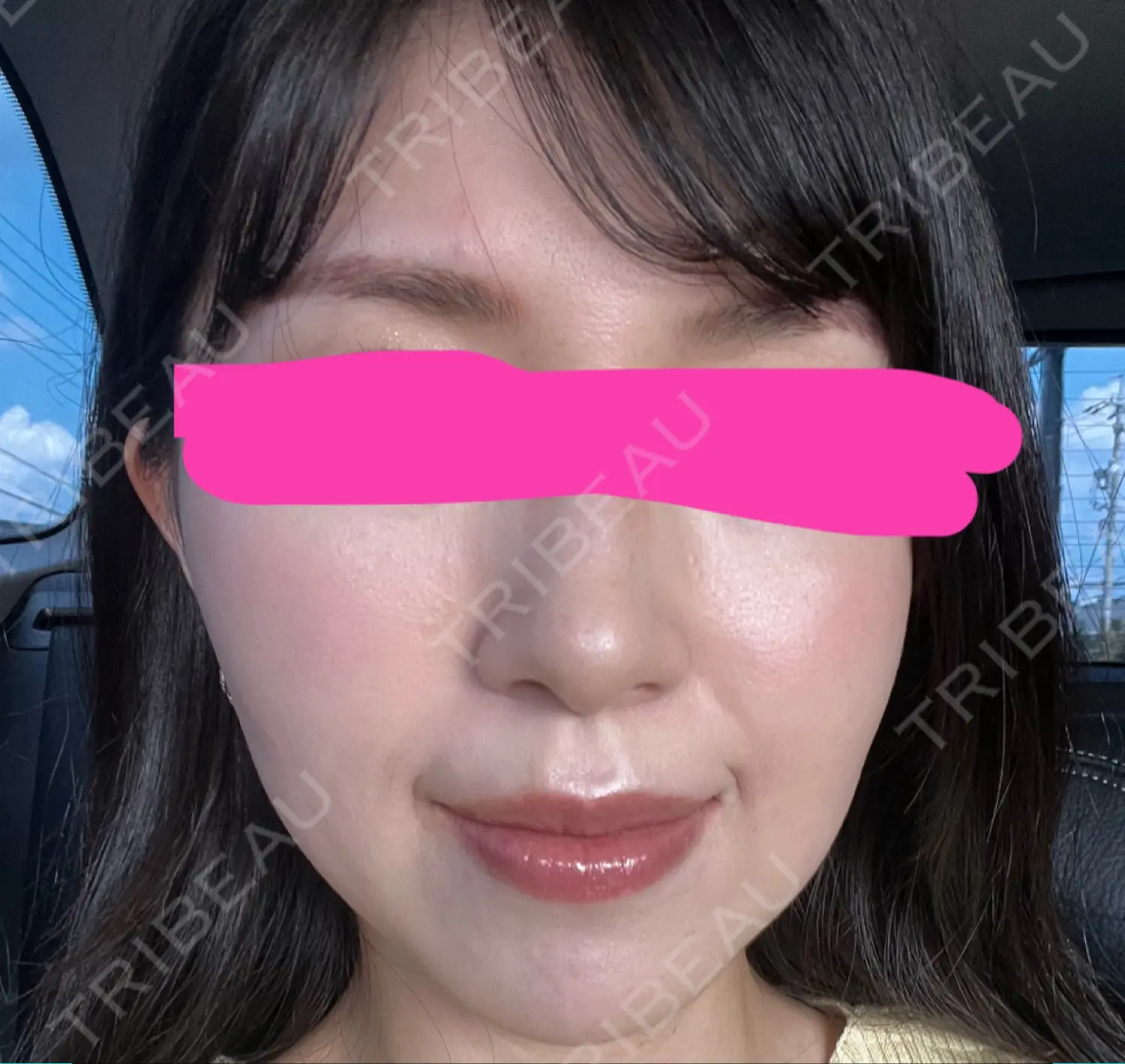 施術前の写真