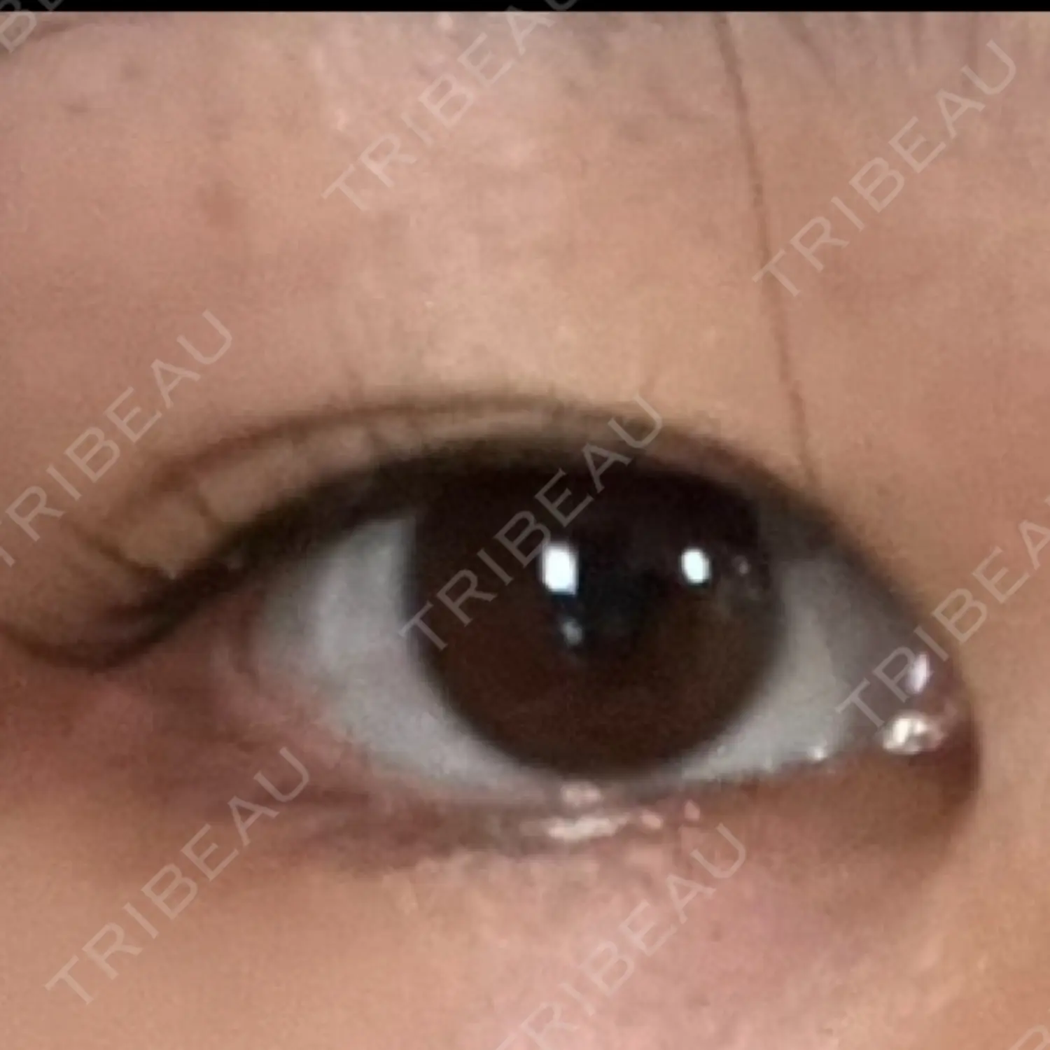 施術前の写真