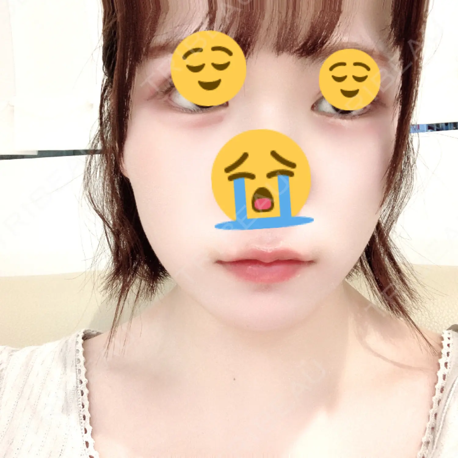 施術前の写真