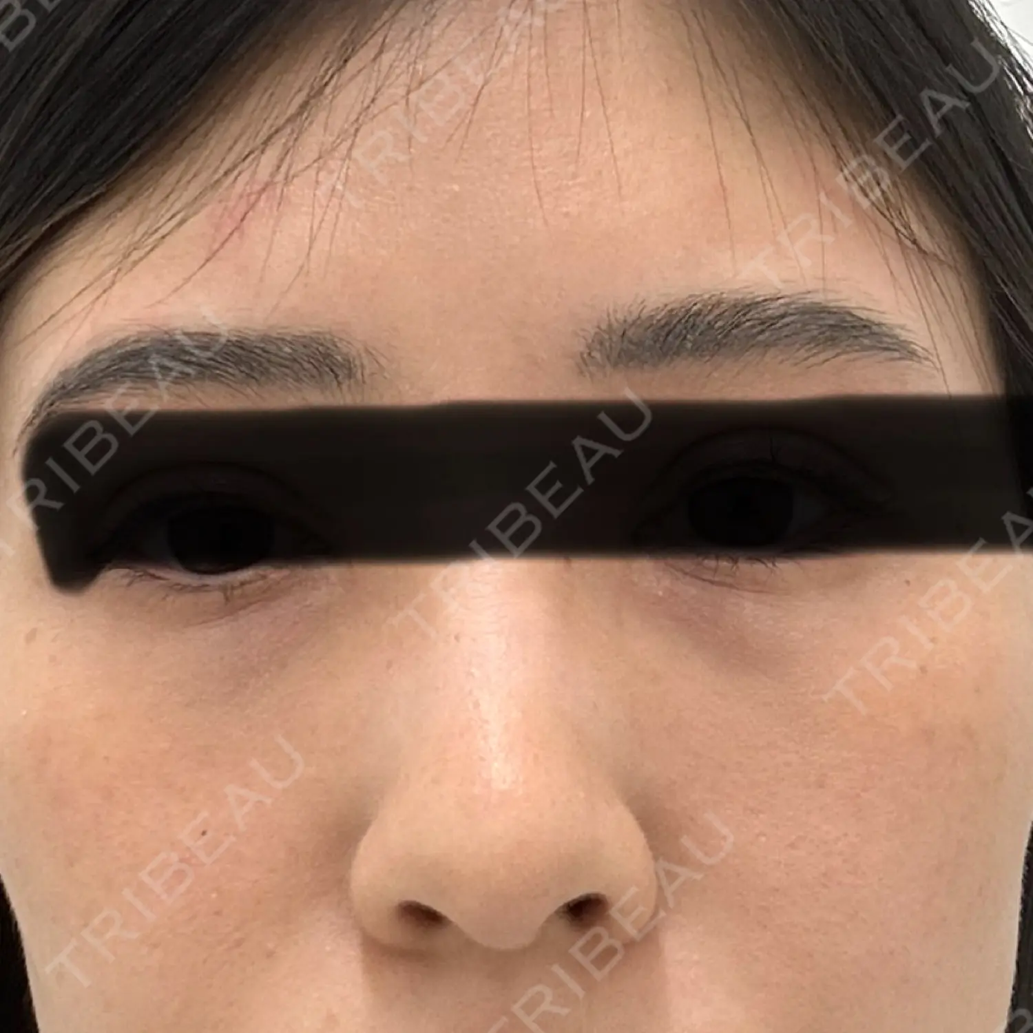 施術前の写真