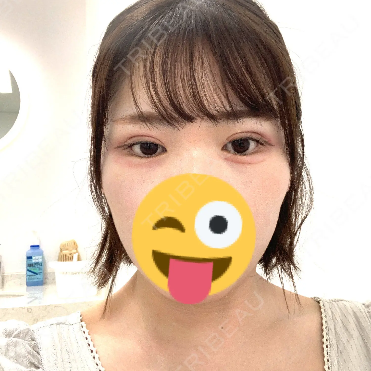 施術前の写真