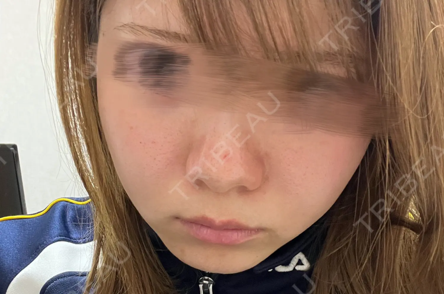 施術前の写真
