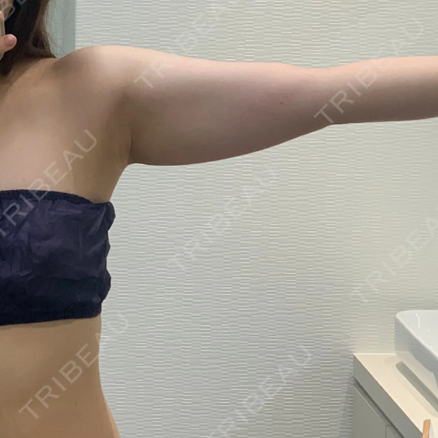 施術前の写真