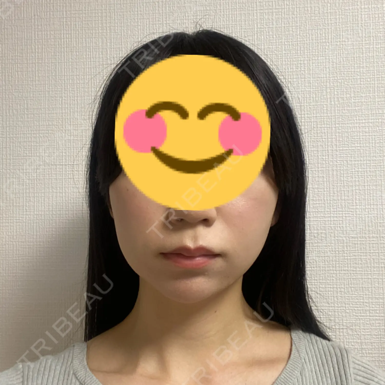 施術前の写真