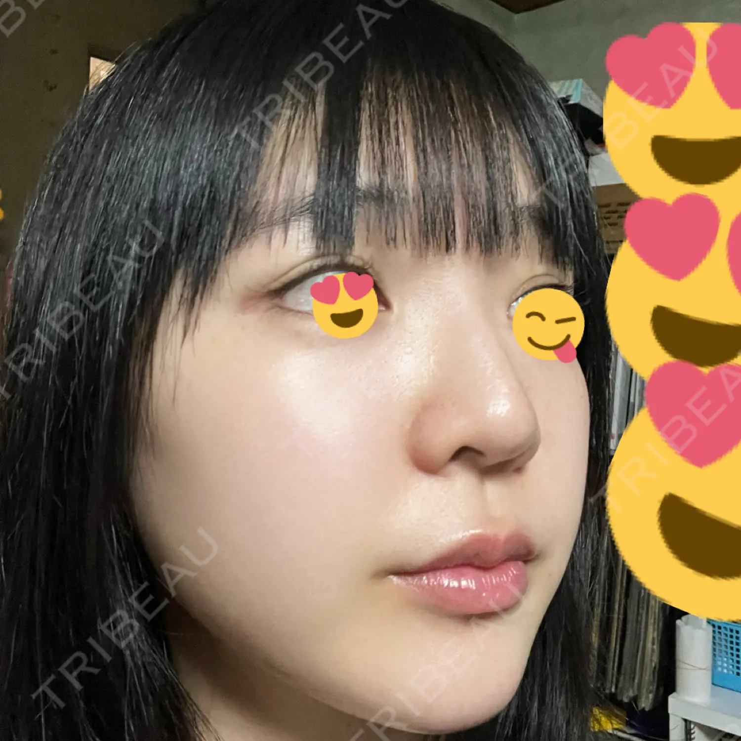 施術前の写真