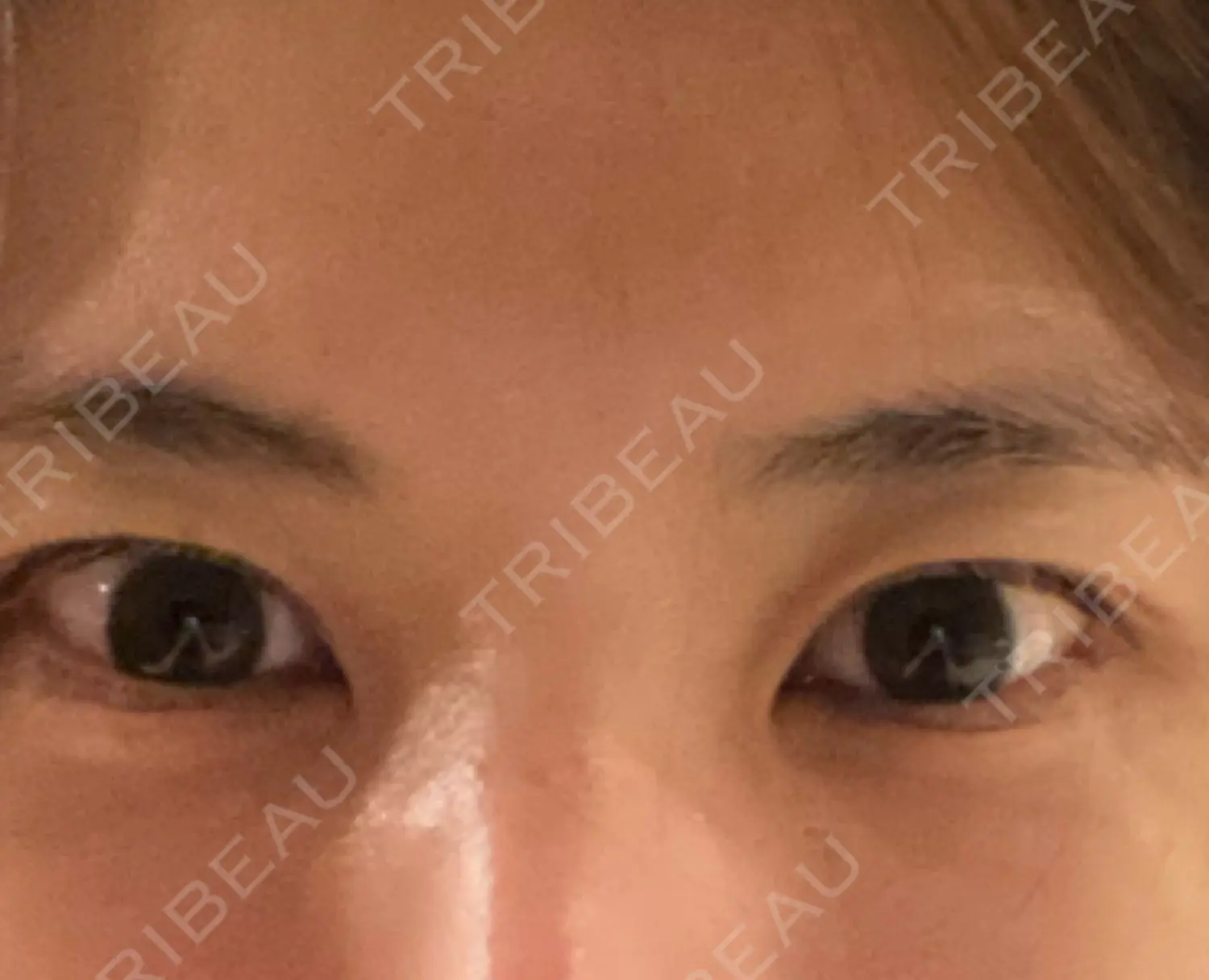 施術前の写真