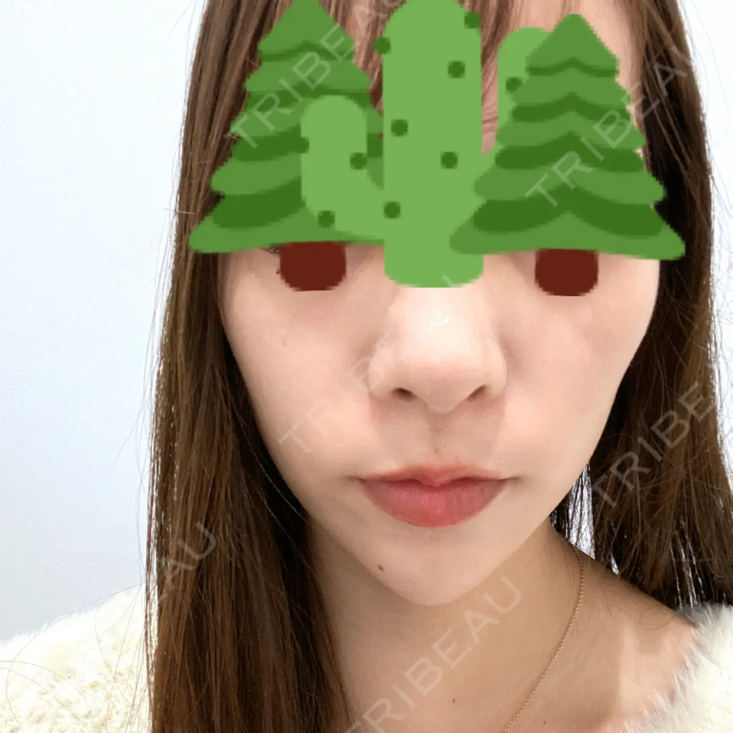 施術前の写真
