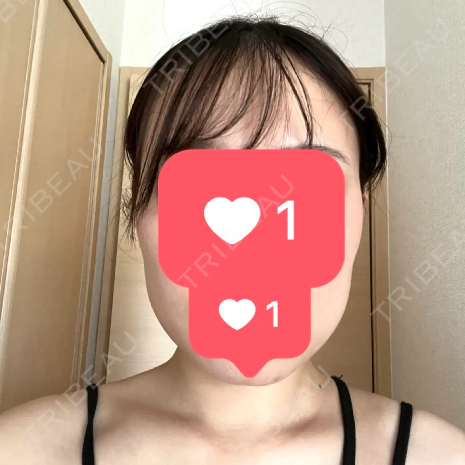 施術前の写真