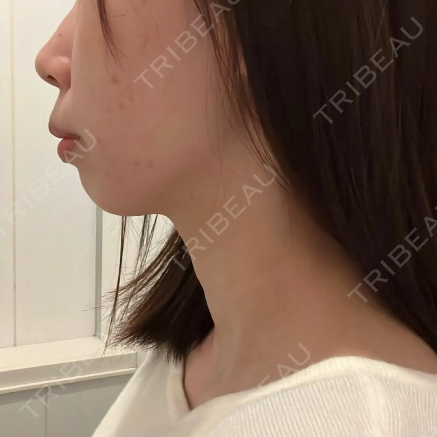 施術前の写真