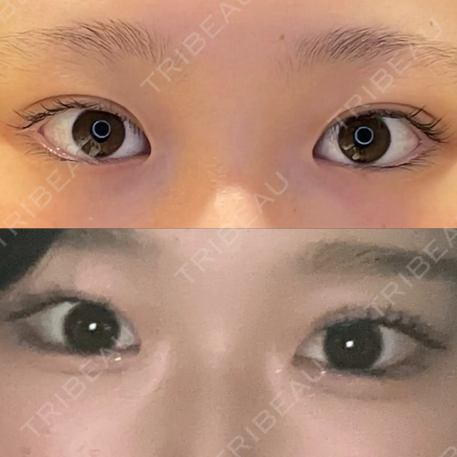 施術前の写真