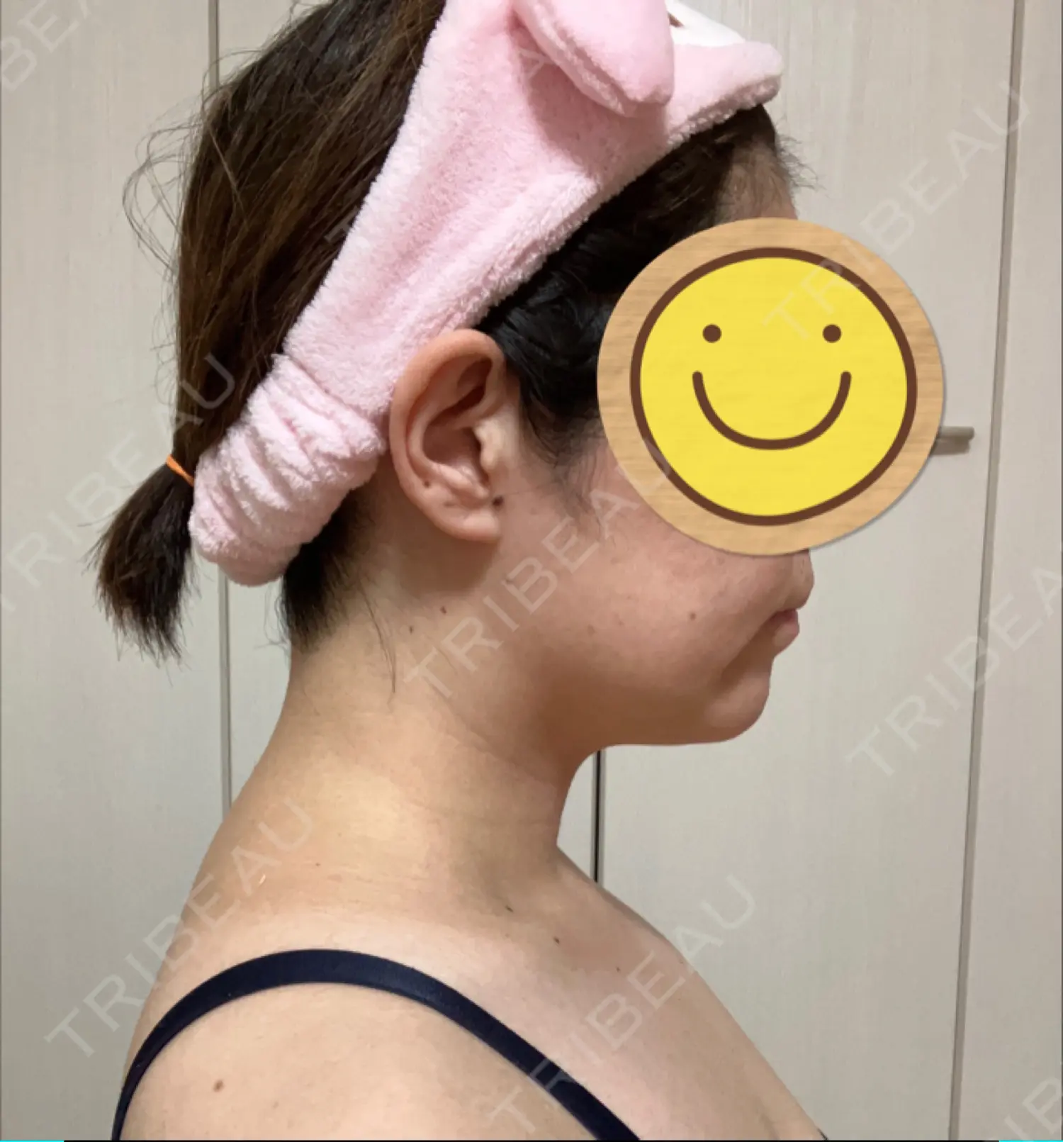 施術前の写真