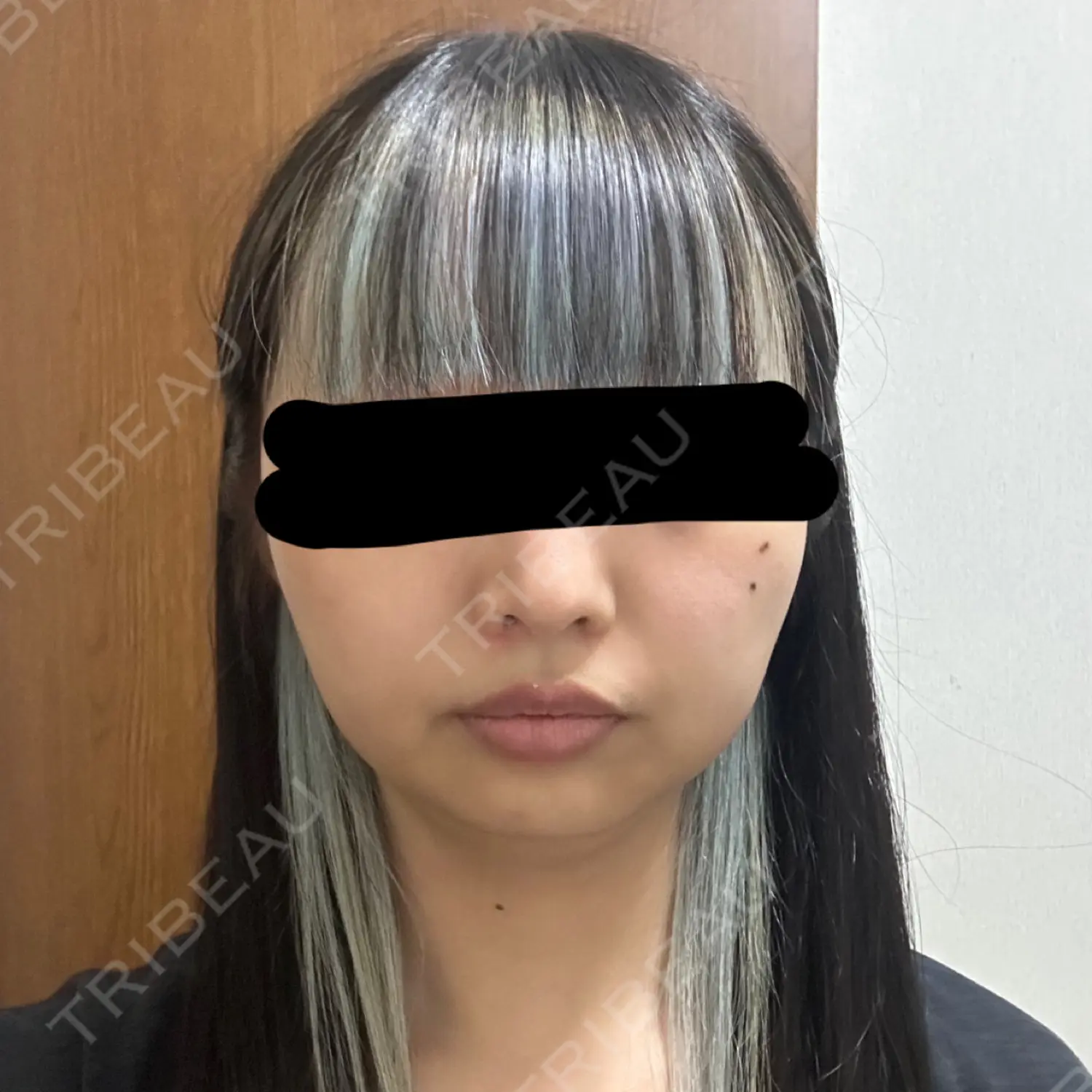 施術前の写真