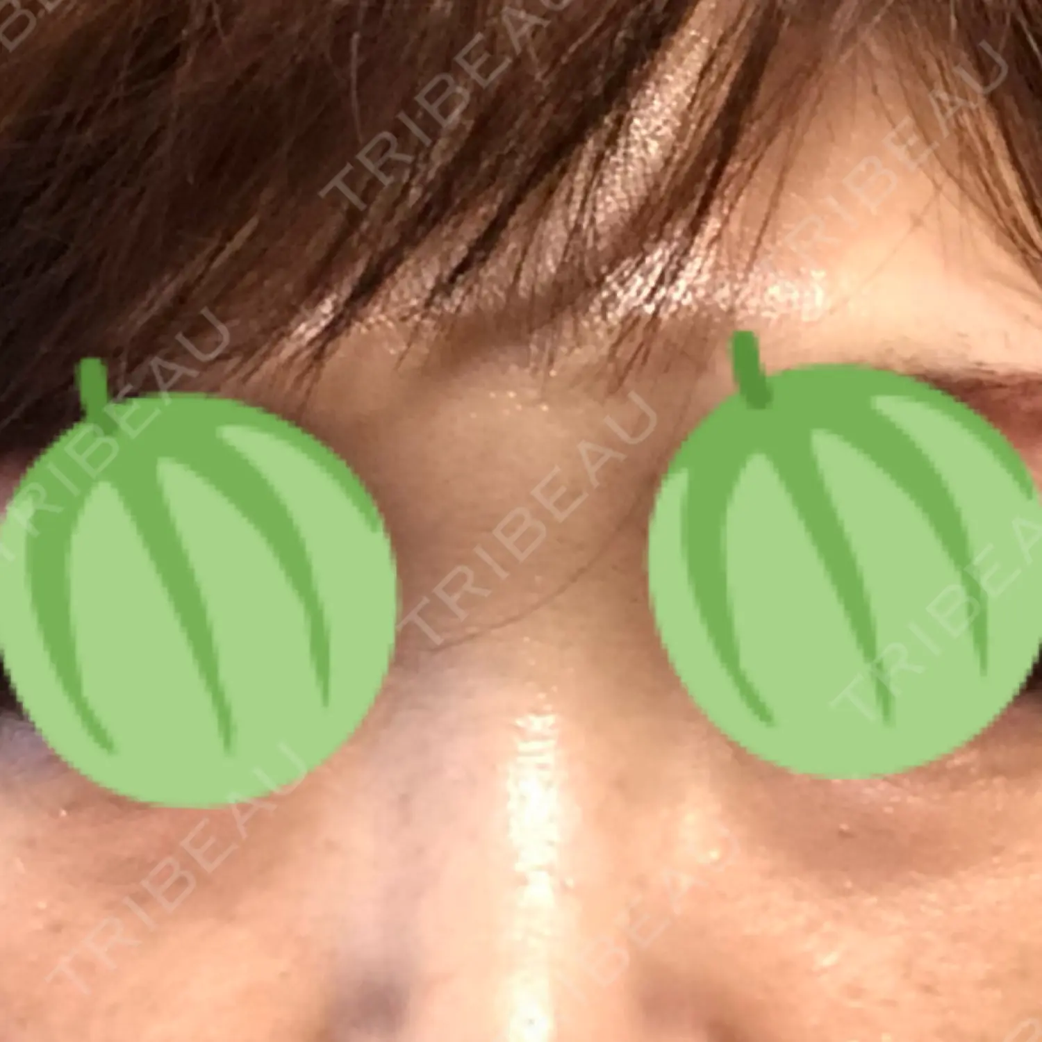 施術前の写真