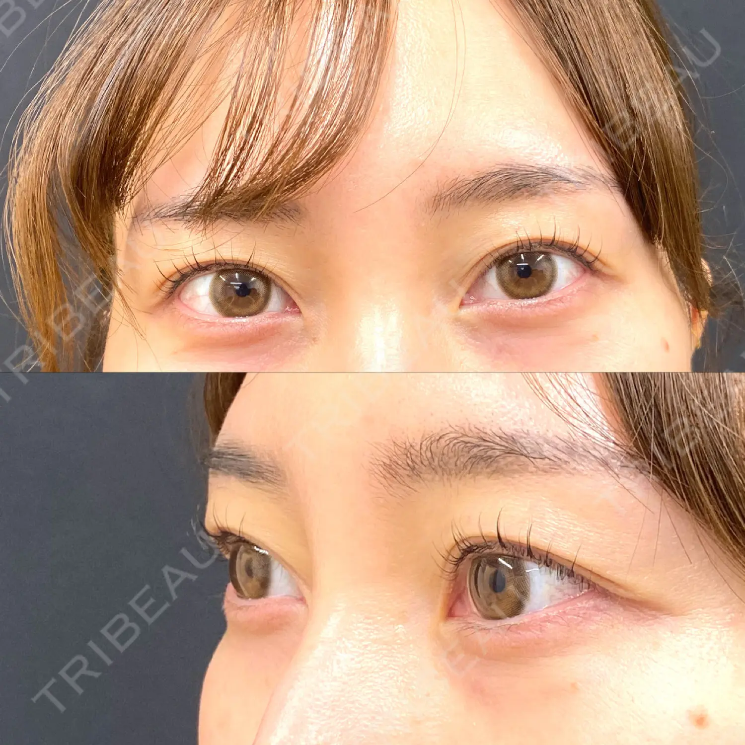 施術前の写真