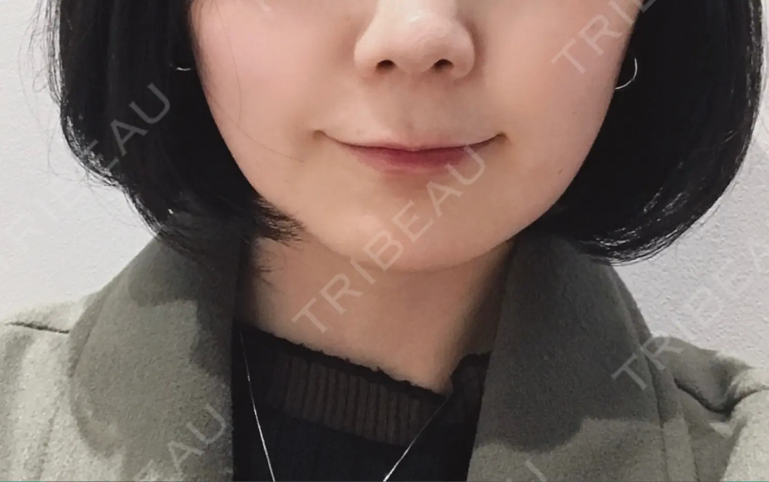 施術前の写真