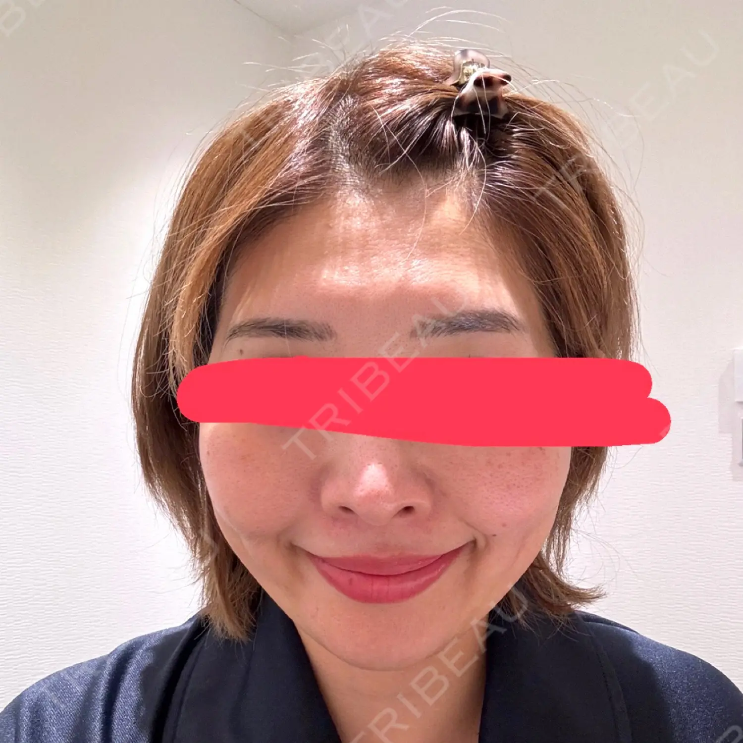 施術前の写真
