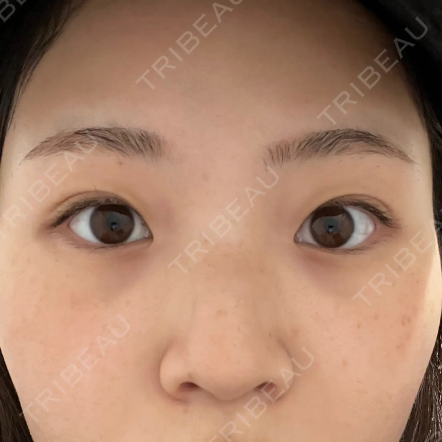施術前の写真