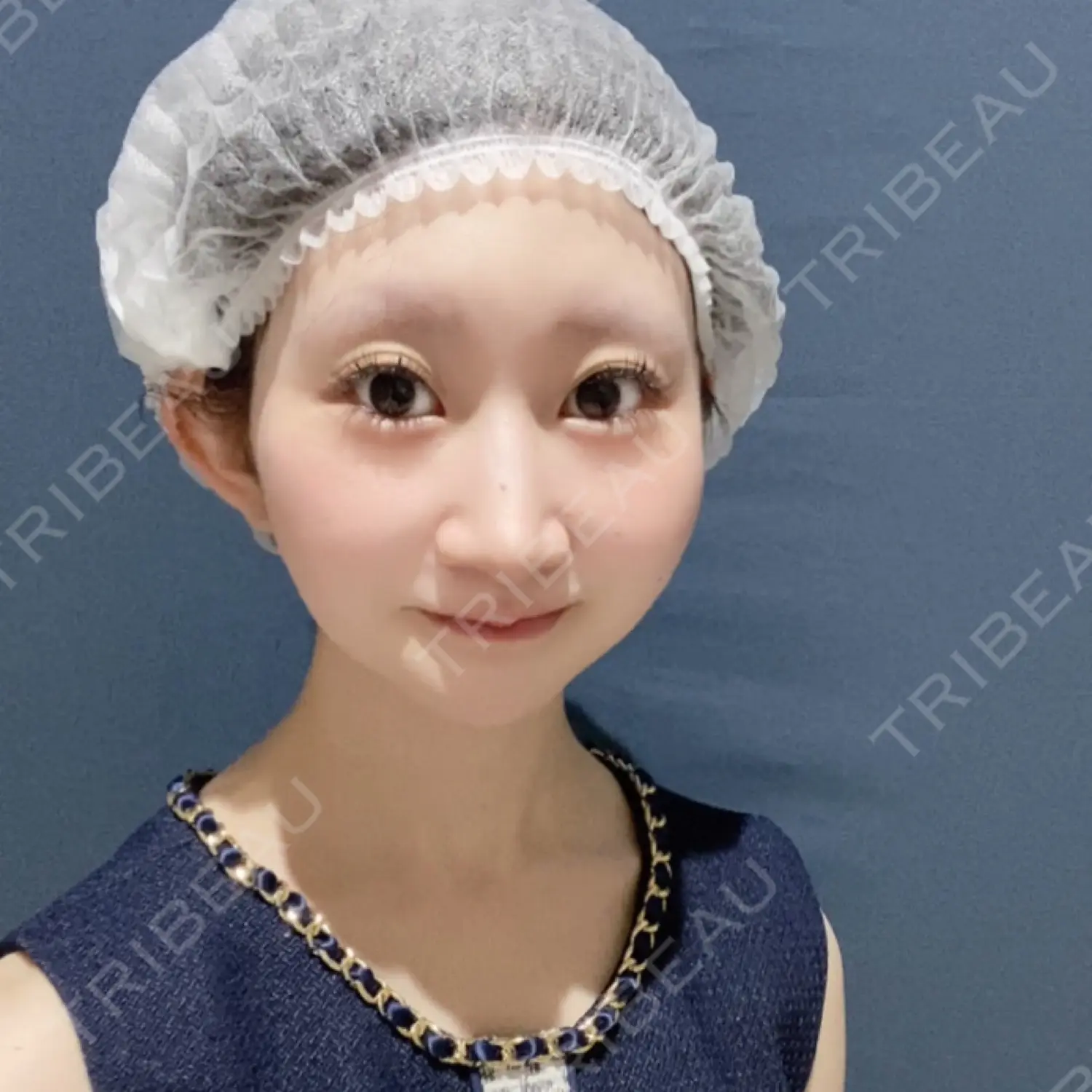 施術前の写真