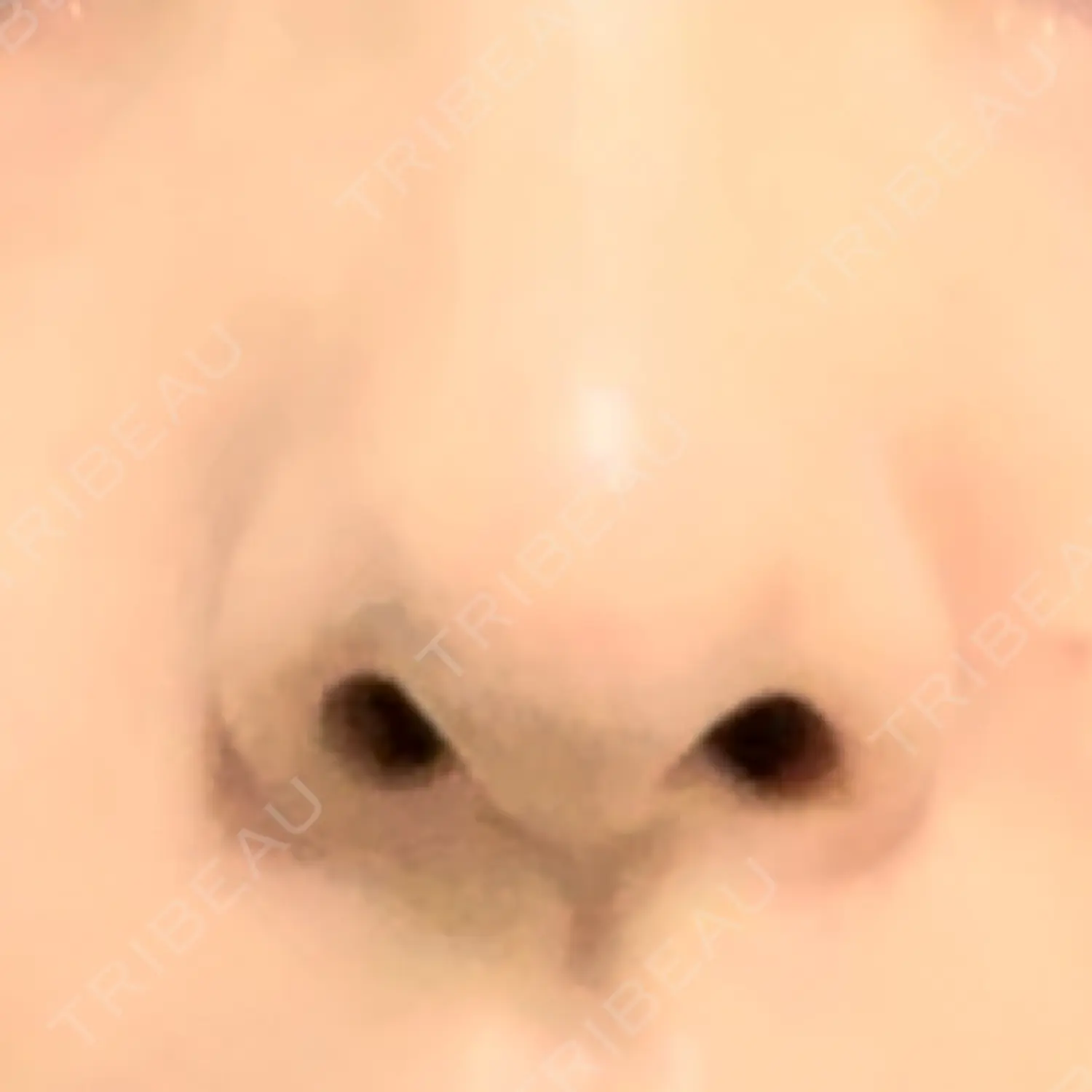 施術前の写真