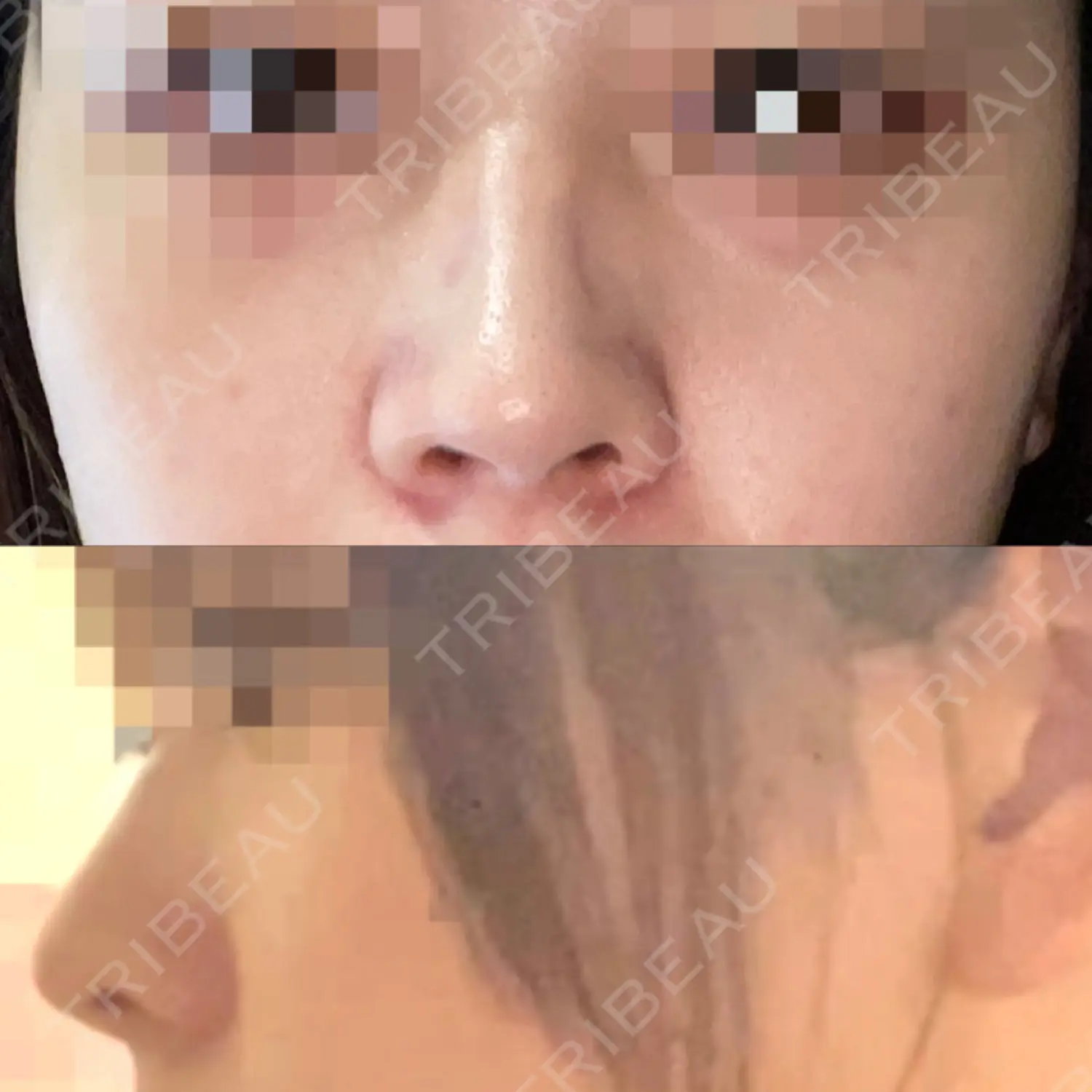 施術前の写真