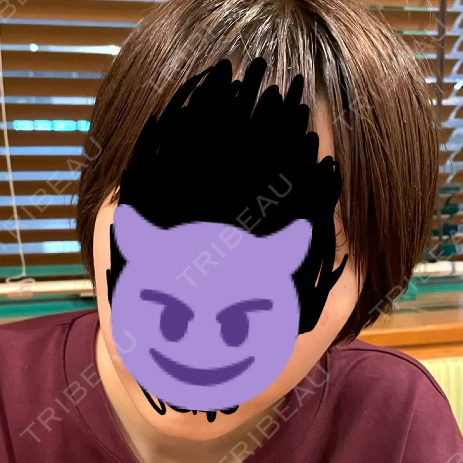 施術前の写真