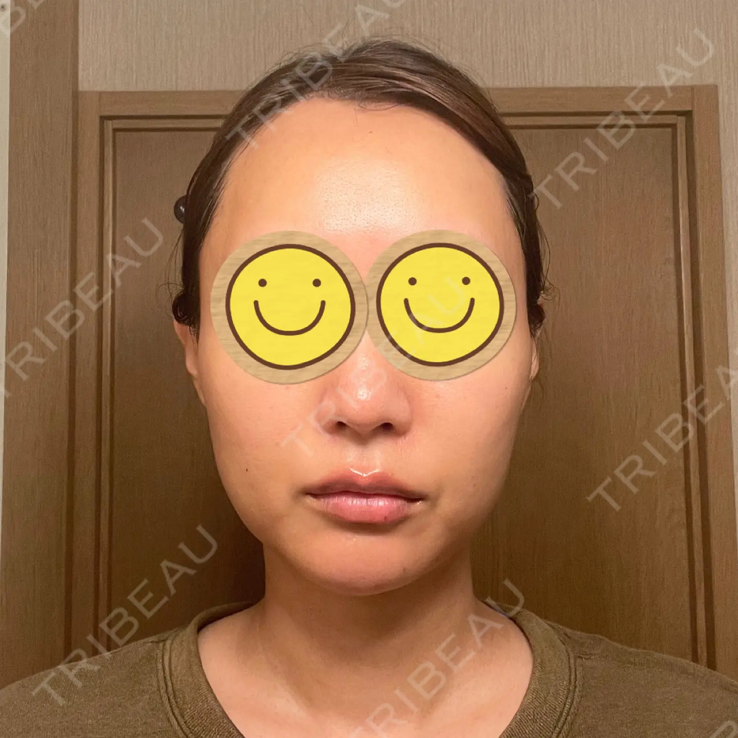施術前の写真