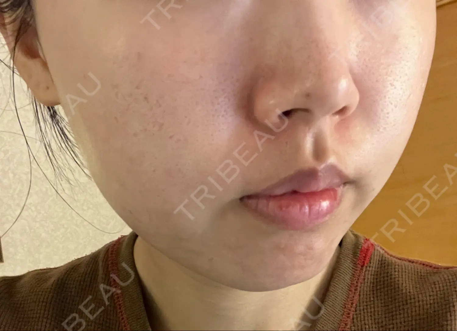 施術前の写真