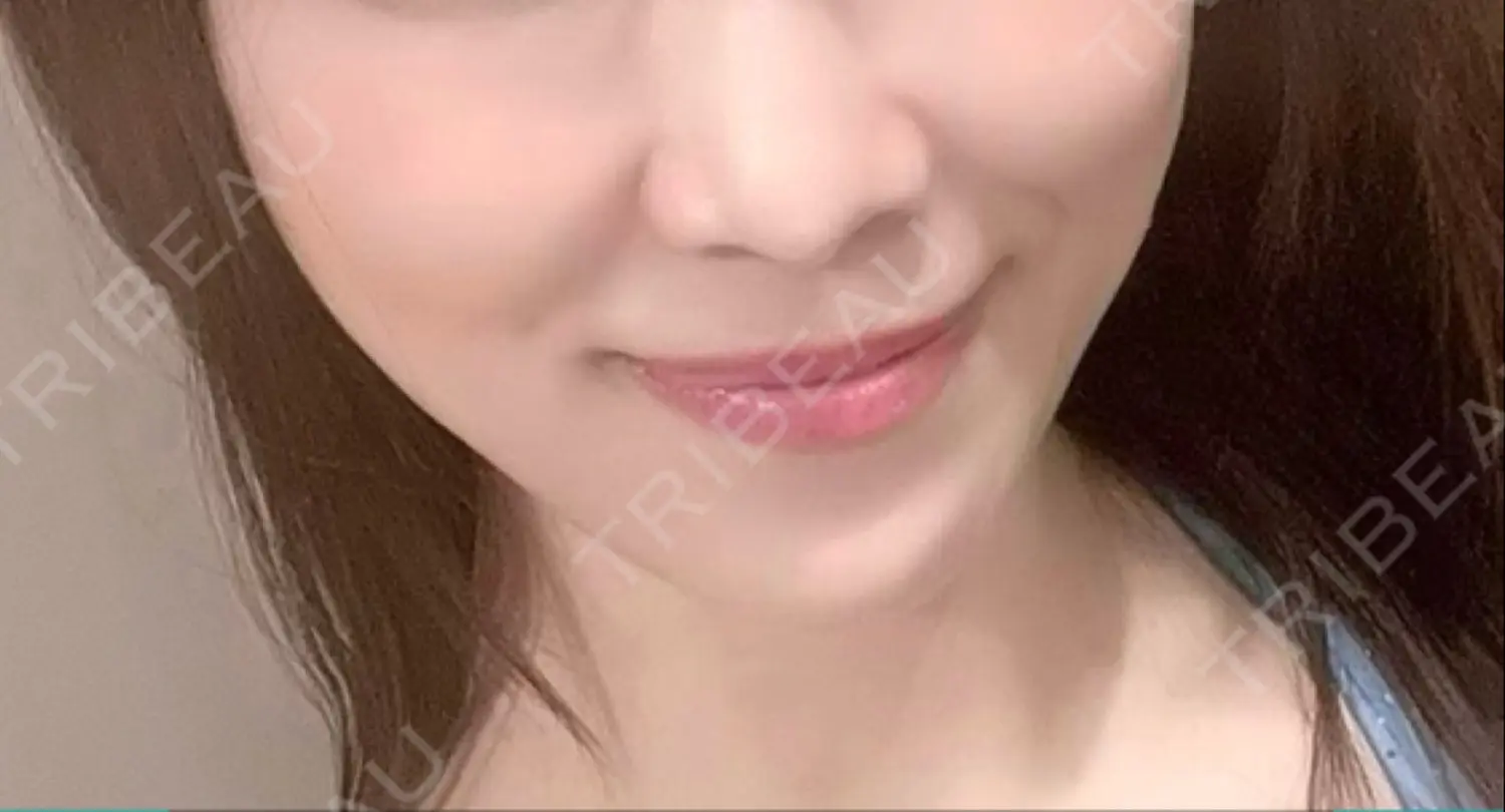 施術前の写真