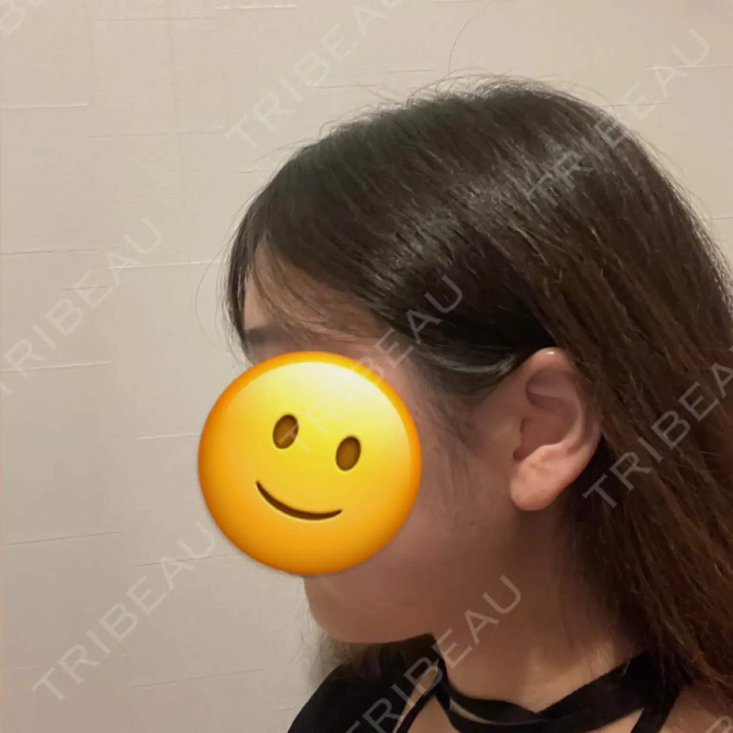 施術前の写真