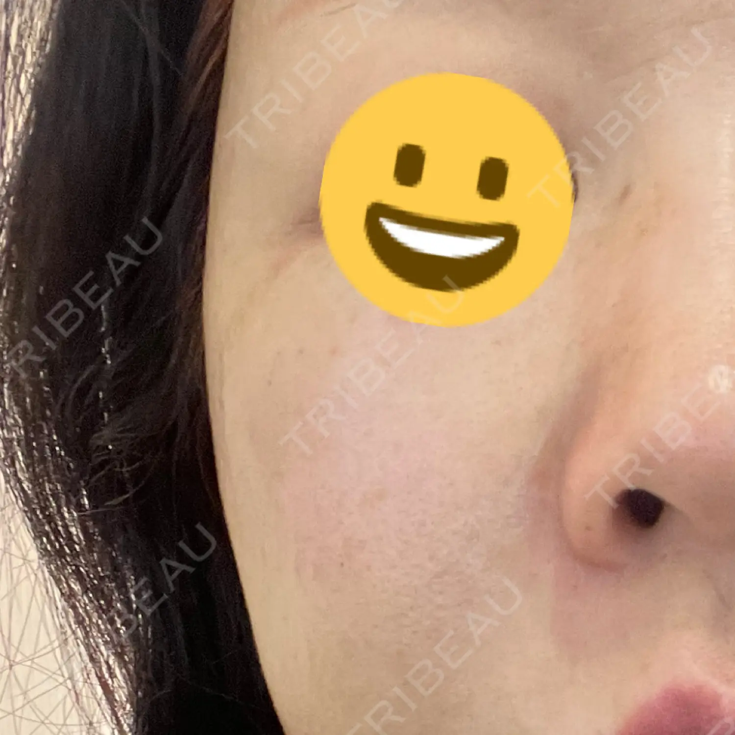施術前の写真