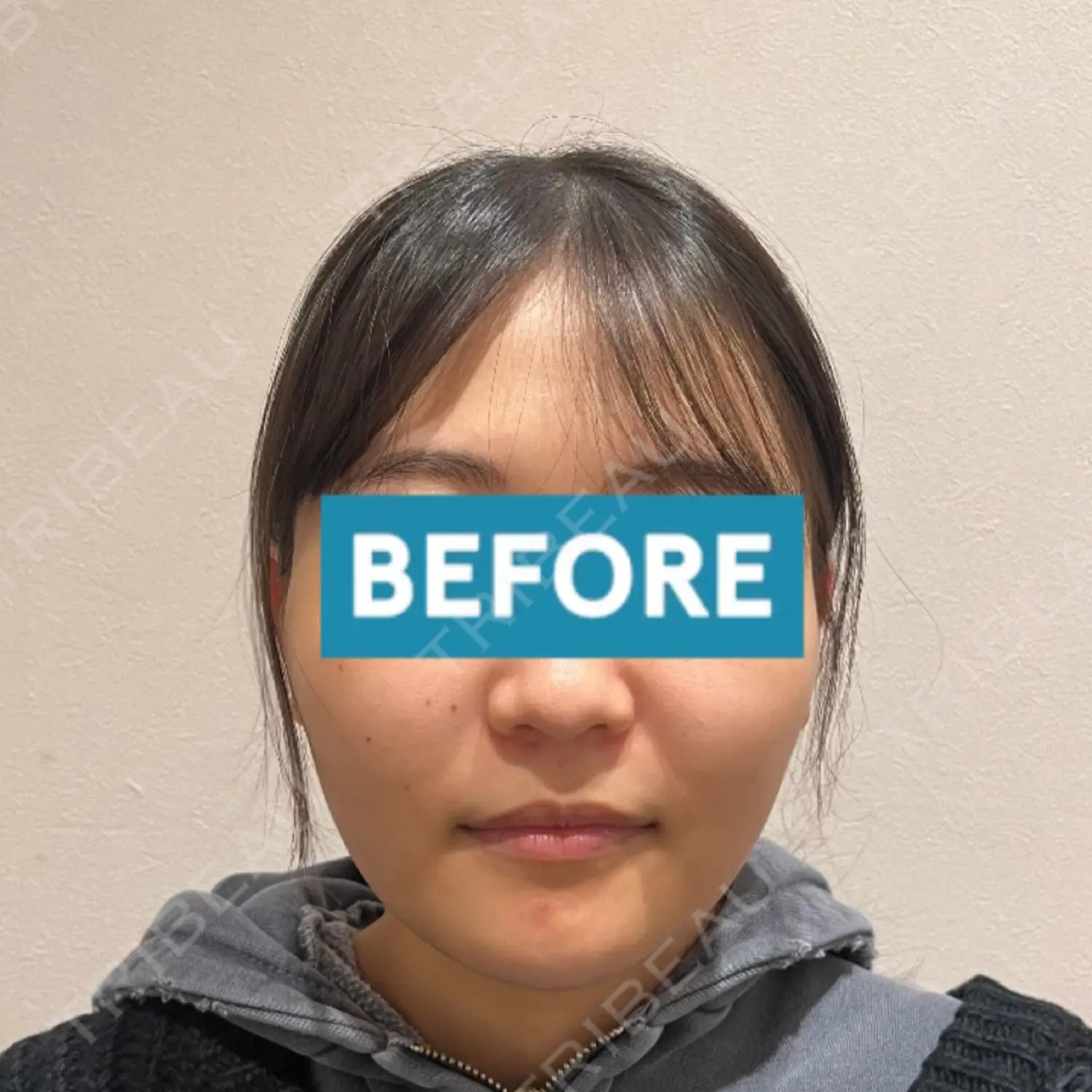 施術前の写真