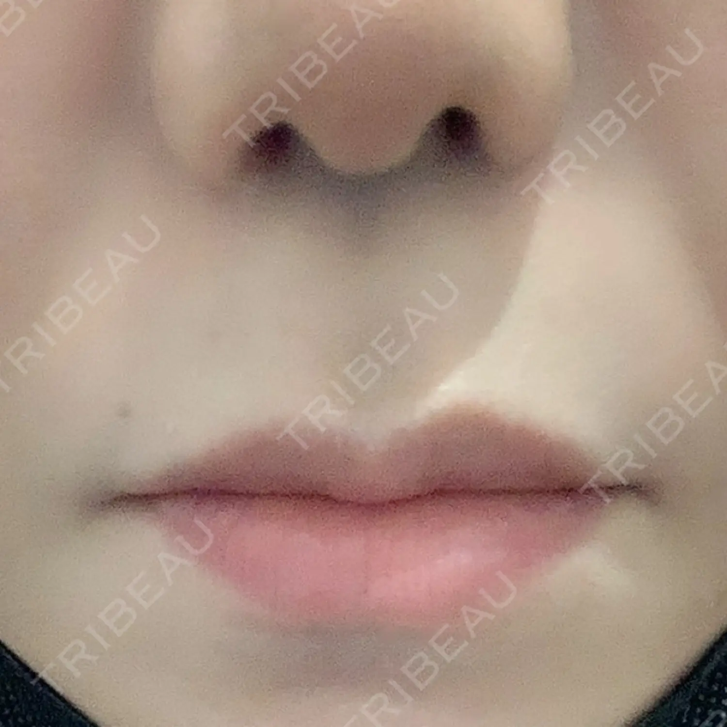 施術前の写真