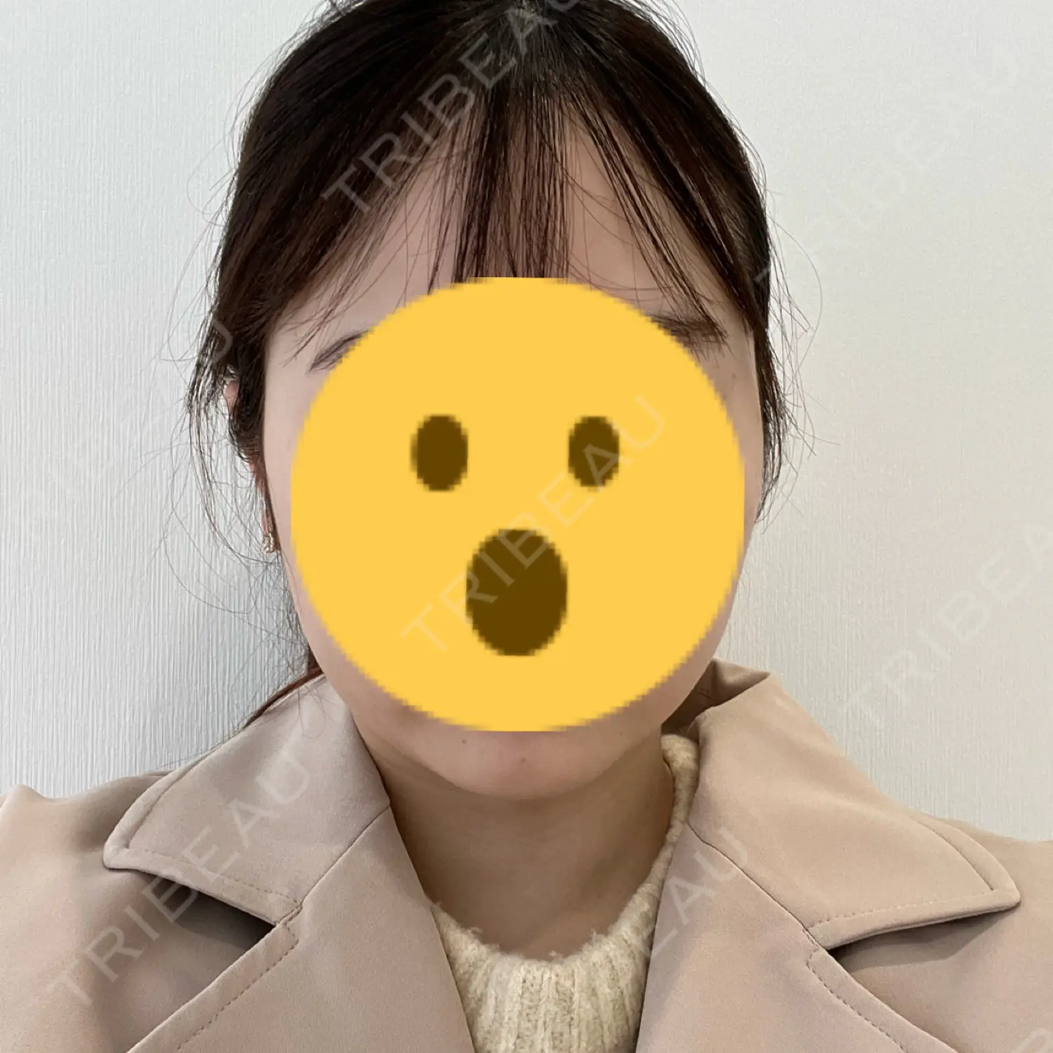 施術前の写真