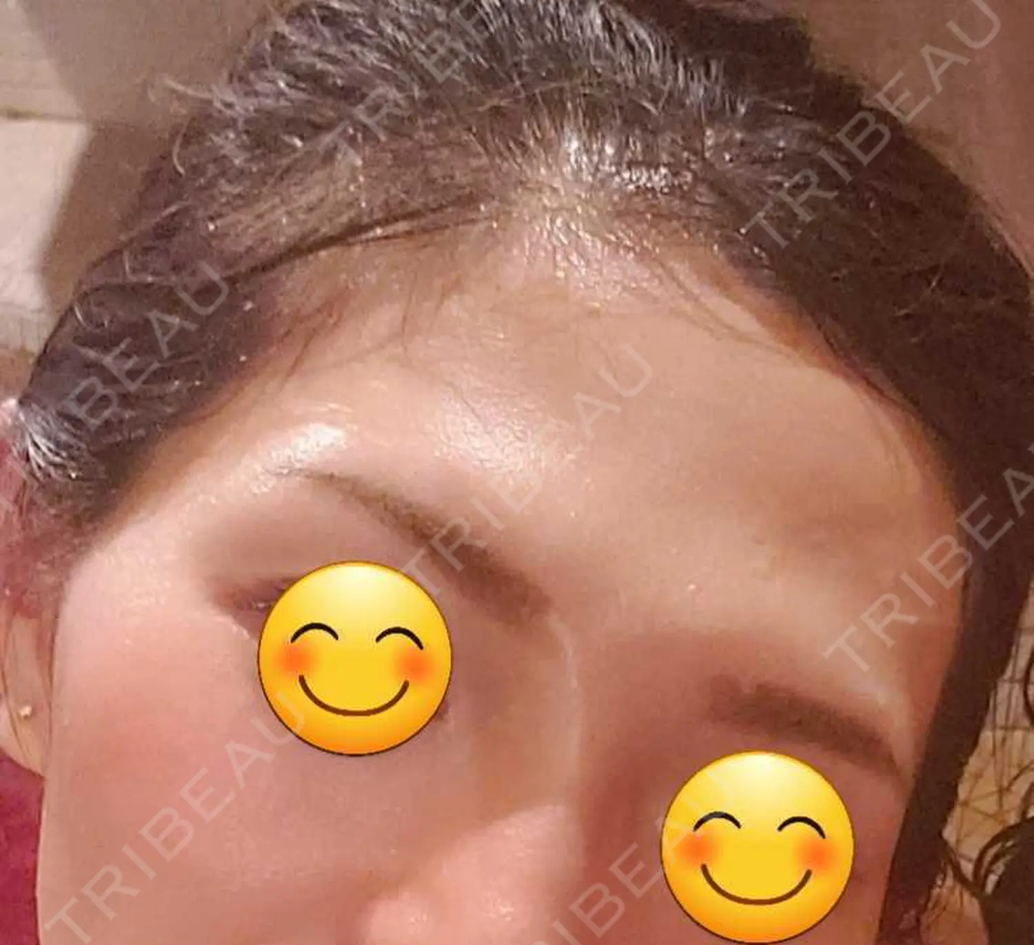 施術前の写真