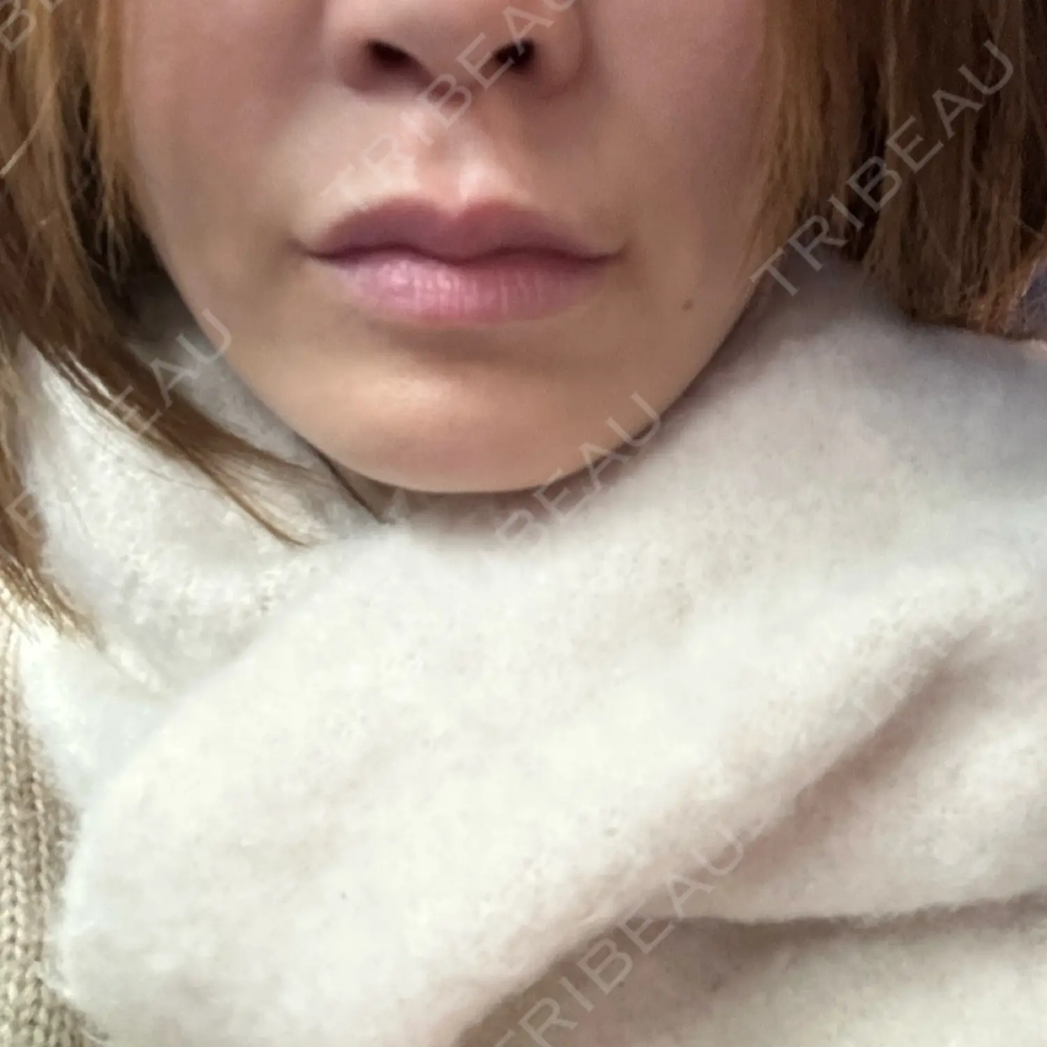 施術前の写真