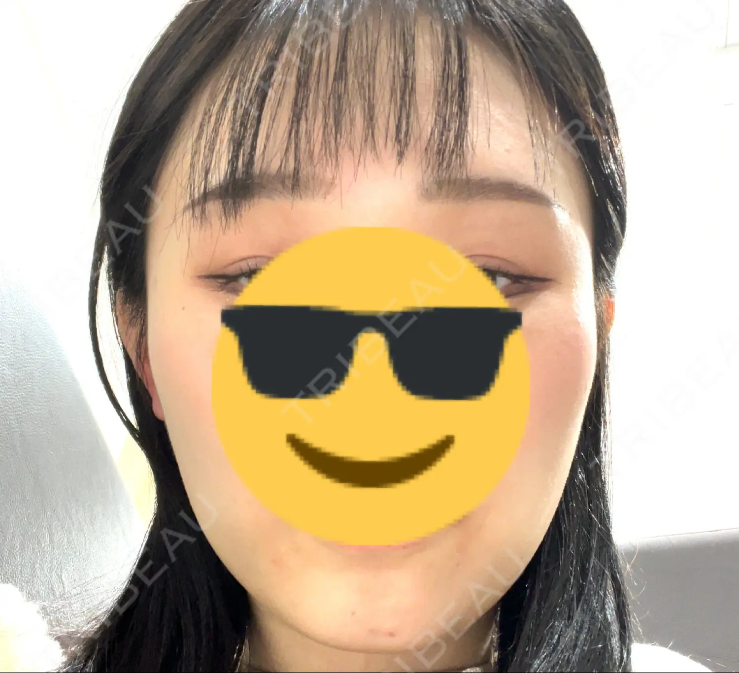 施術前の写真