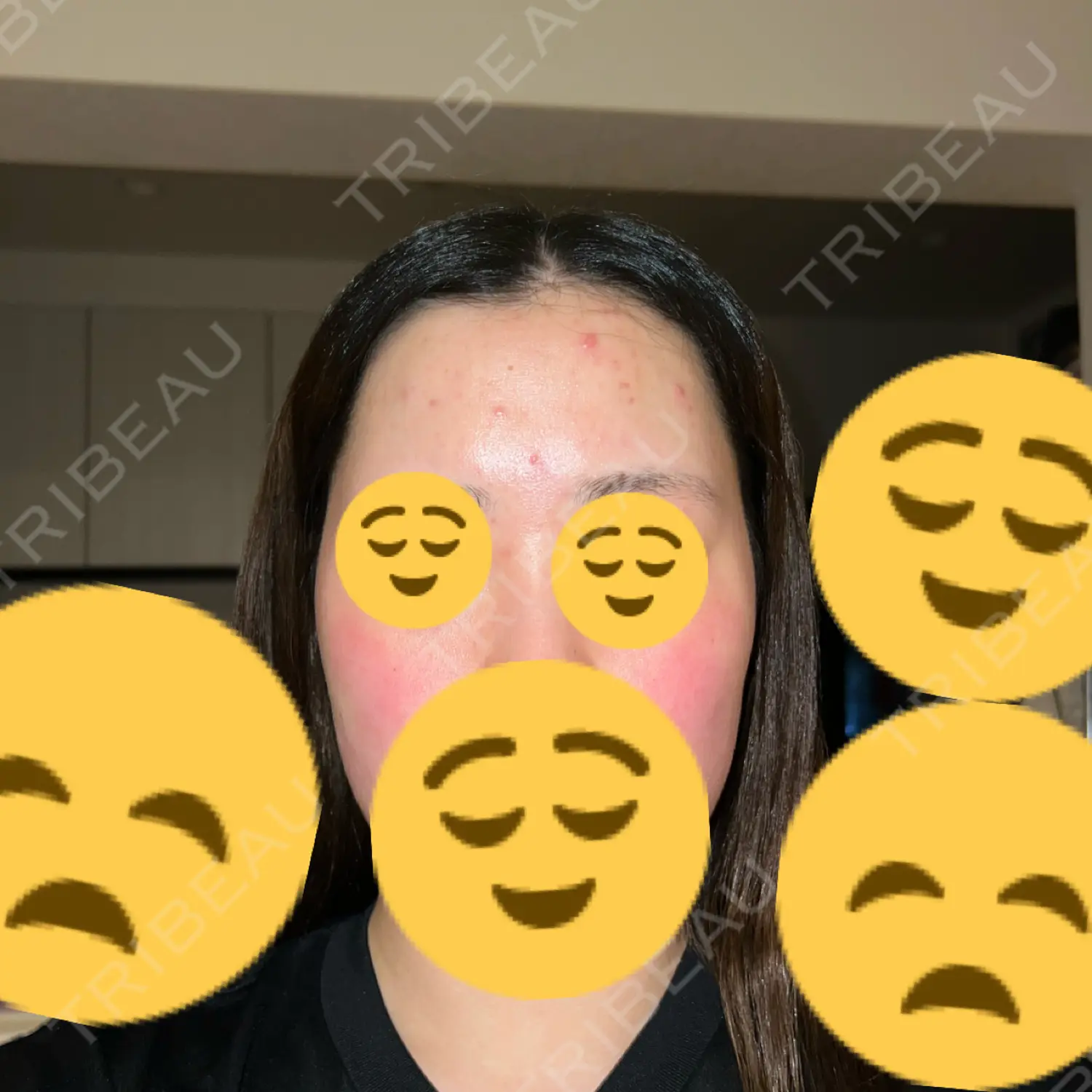 施術前の写真