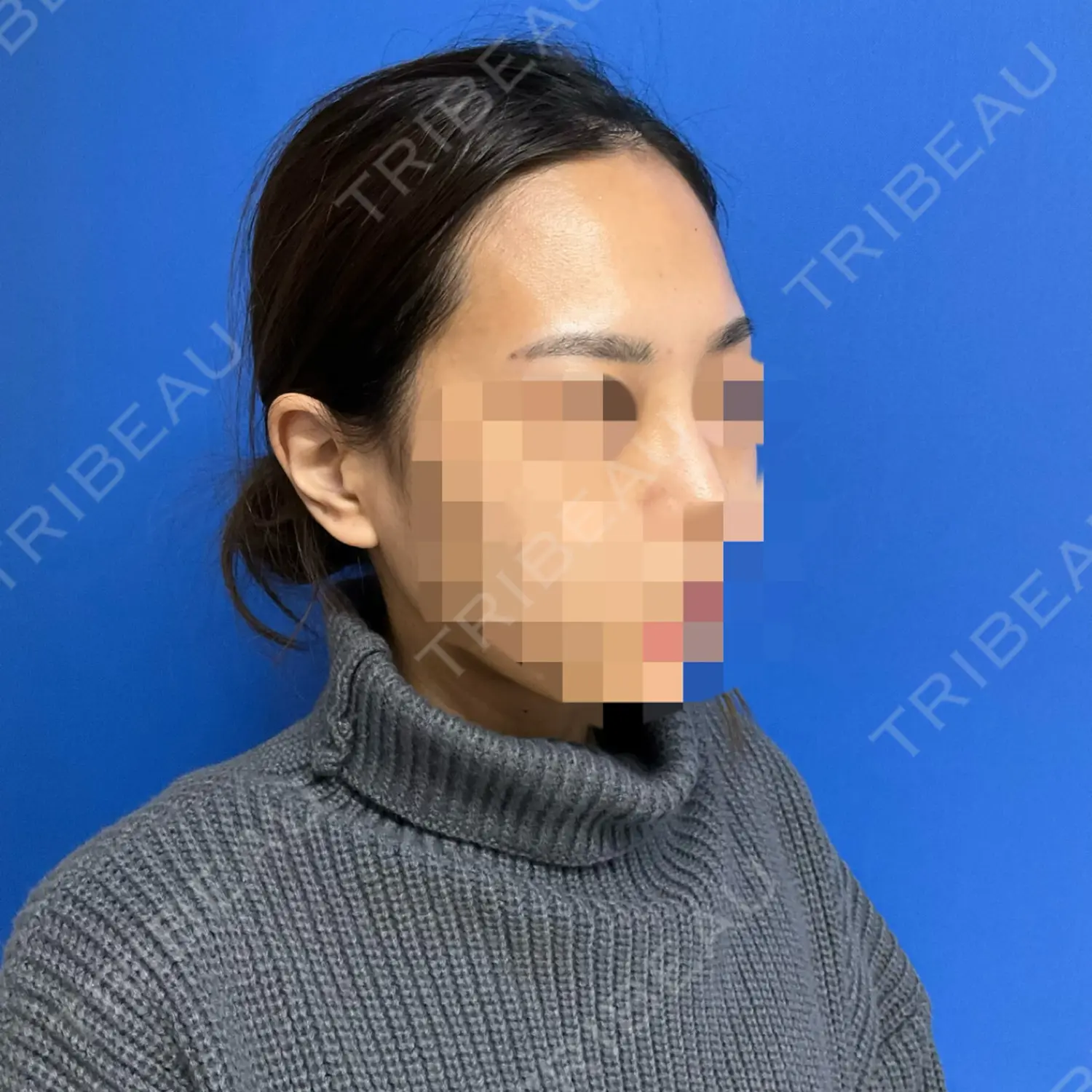 施術前の写真