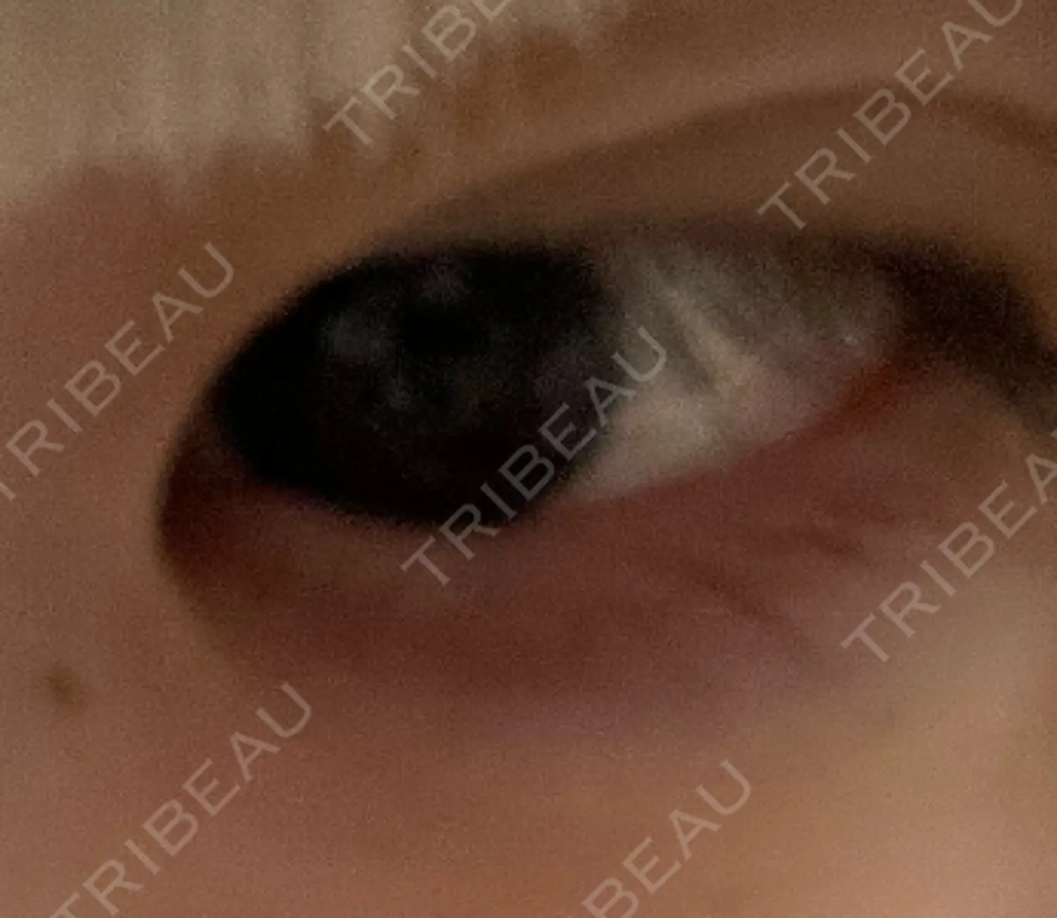 施術前の写真
