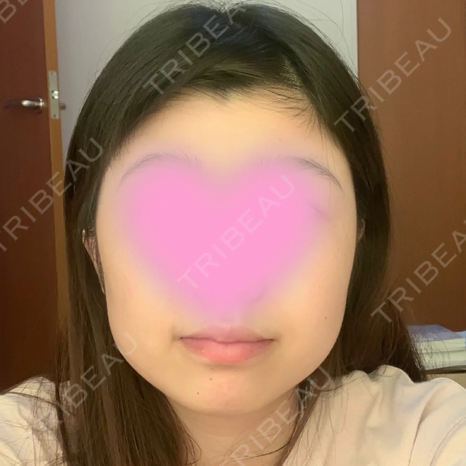 施術前の写真