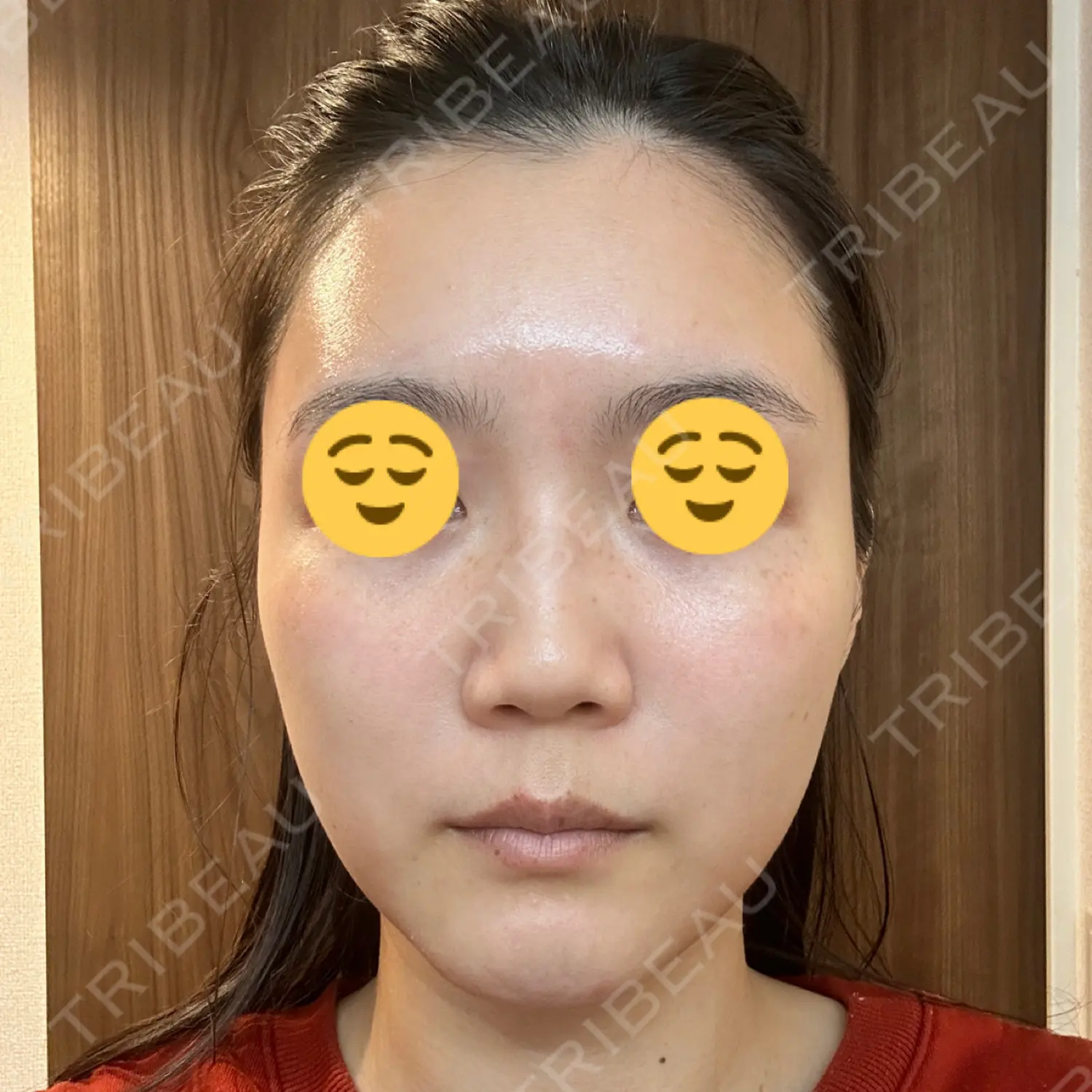 施術前の写真