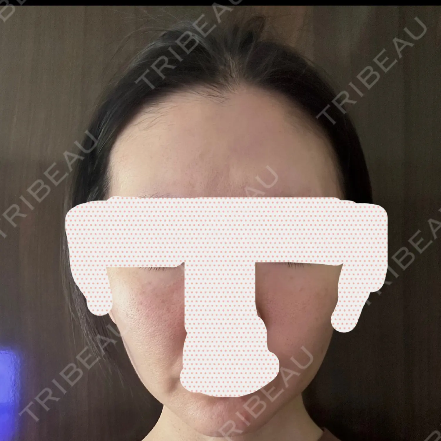 施術前の写真