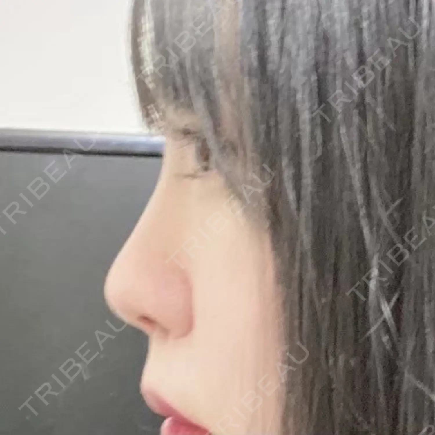 施術前の写真