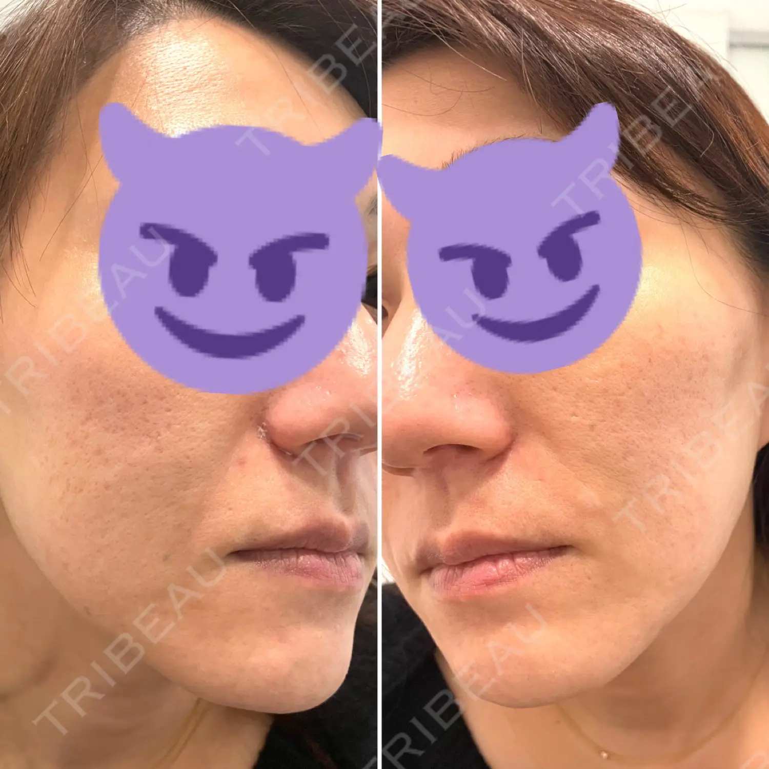 施術前の写真