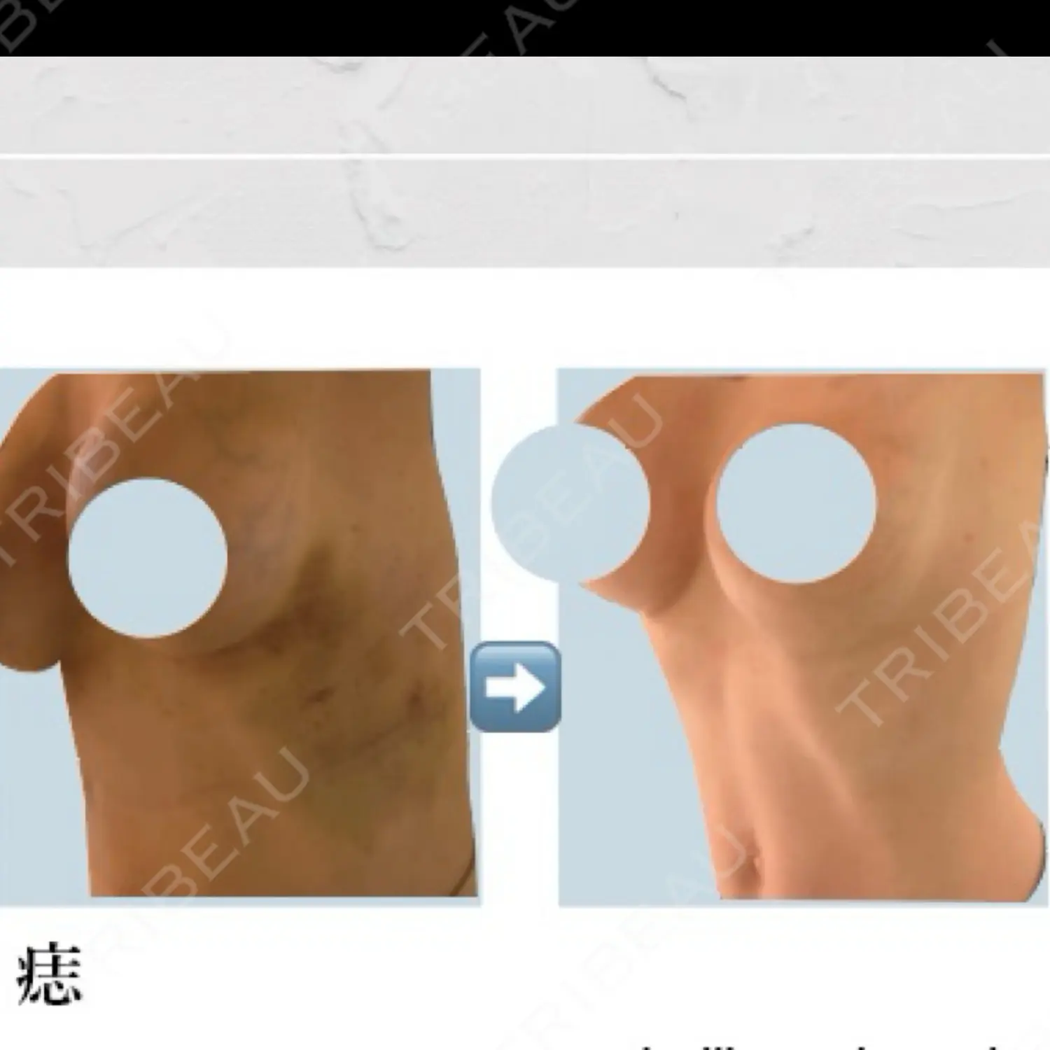 施術前の写真